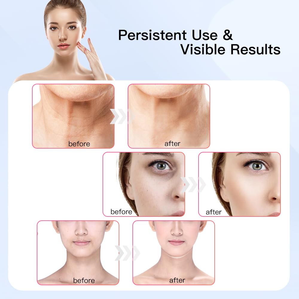 Neck & Face Massager with Vibration & Heat - Multifunctional Facial Sculpting Tool for Skin Care & Relaxation (White Gold) | Perfect for Home Spa, Anti-Aging Routine & Stress Relief