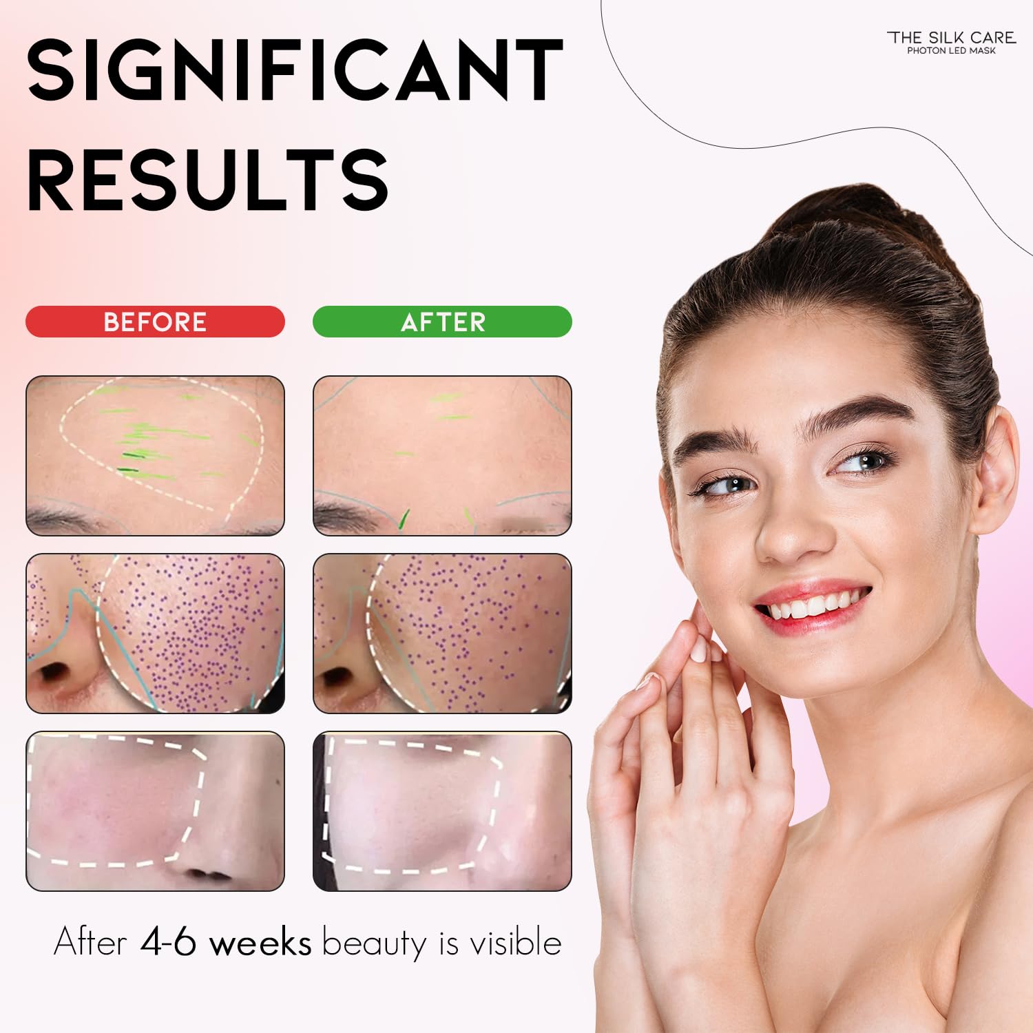 Red Light Therapy Mask for Face - 7 Color LED Light Therapy Device for Skin Rejuvenation & Anti-Aging | At-Home Spa Treatment for Wrinkles, Acne & Collagen Boost