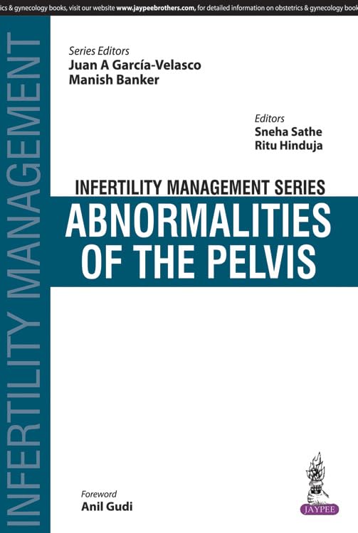 Pelvic Abnormalities and Infertility Treatment Guide - Diagnosis & Management Solutions for Reproductive Health | Fertility Clinic & Home Care Use
