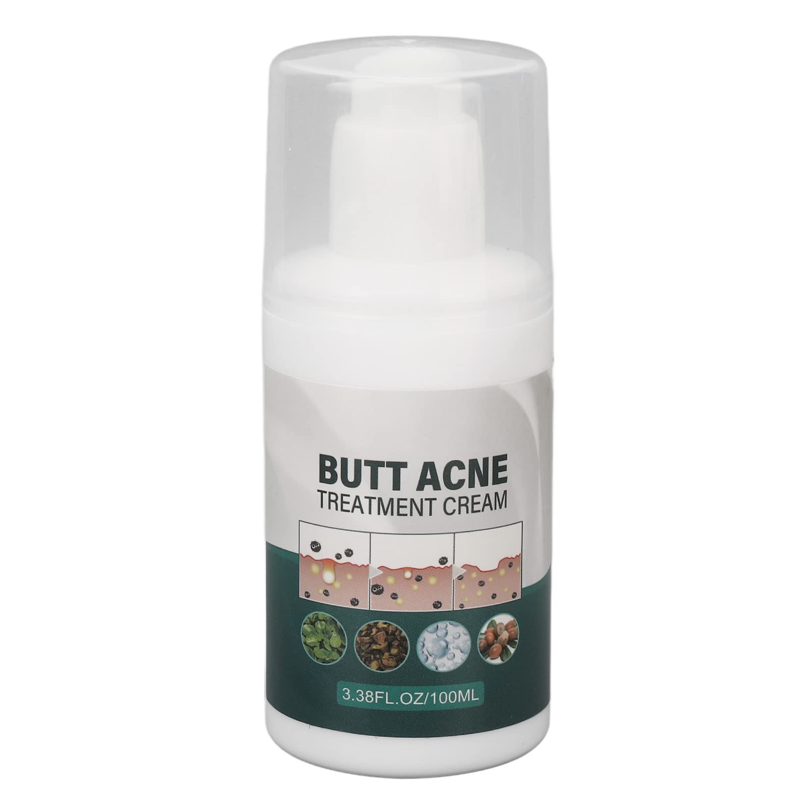 Best Buttock Pimple Treatment Cream - Acne Cleansing & Skin Moisturizing Repair for Thigh & Butt Area | Prevent & Soothe Breakouts for Smooth Skin | Perfect for Post-Workout, Travel & Daily Care