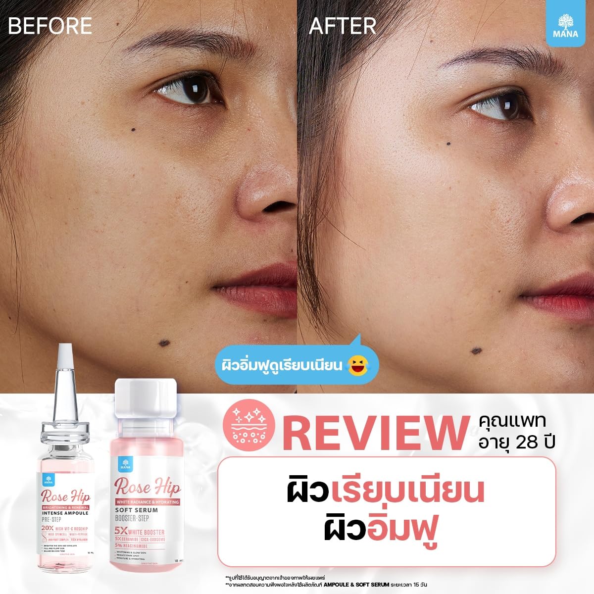 Moisture Nourishing Skin Care Set - 18ml Hydrating Soft Serum (10-Pack) by Thaigiftshop | For Dry & Sensitive Skin | Free Tomato Facial Mask Included | Perfect for Daily Skincare Routine & Travel
