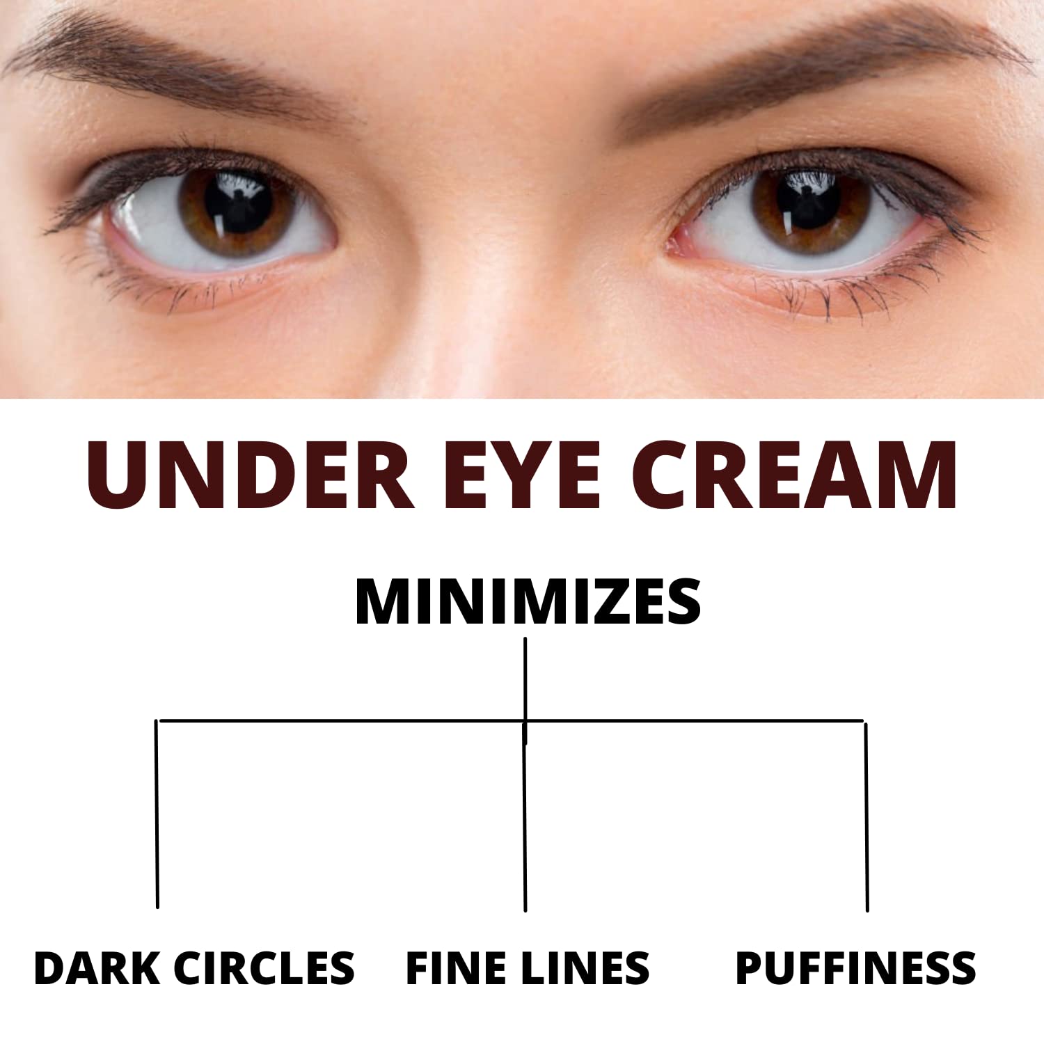 INTIMIFY Dark Circle Remover Eye Cream for Women & Men - Under Eye Treatment with Shea Butter (20g) - Reduce Puffiness & Brighten Dark Circles for Day & Night Use