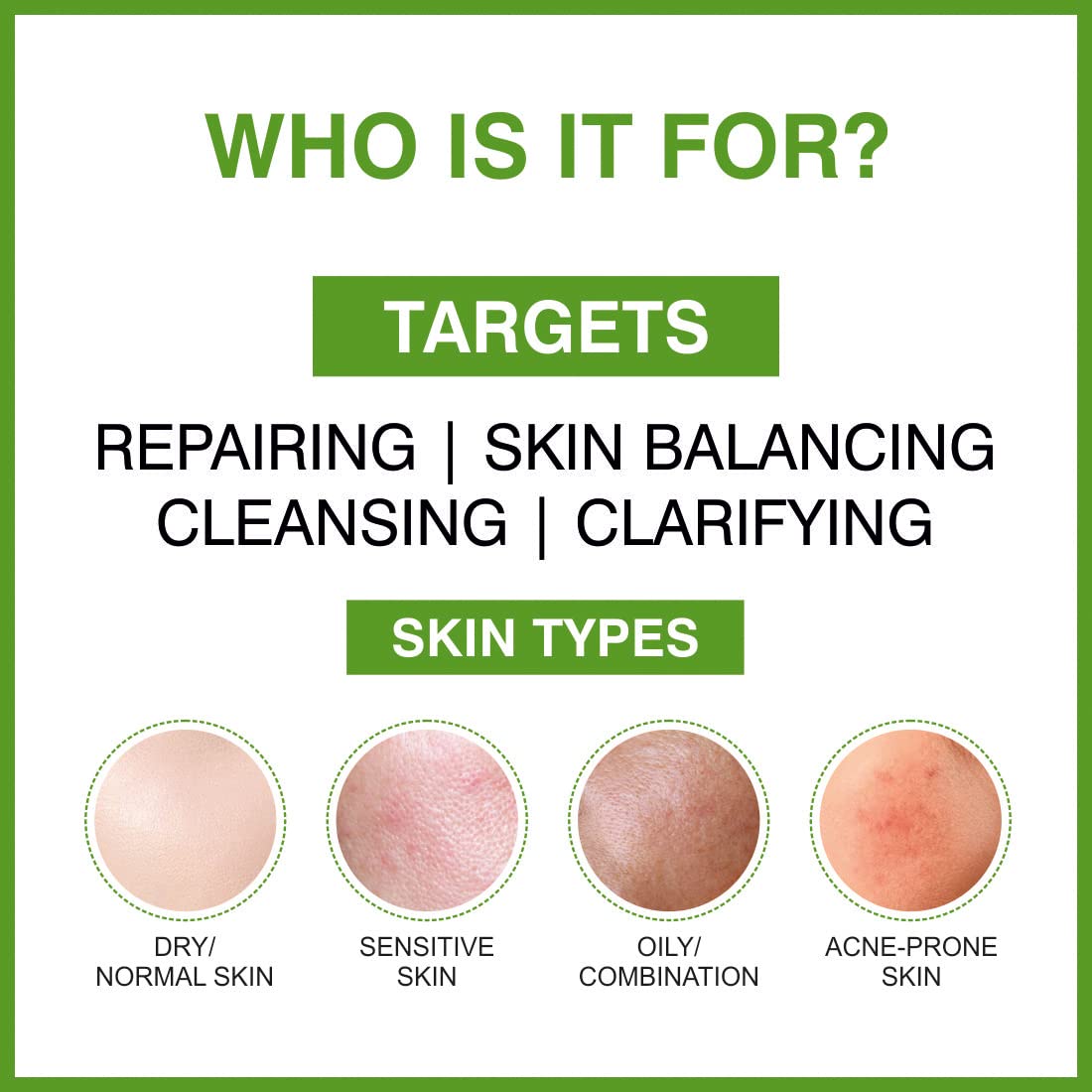 She Essentials Green Tea Face Serum with Aloe Vera Extract, Pro Vitamin B5 & Vitamin E | Anti-Aging, Skin Repair, Reduces Blemishes & Fine Lines | Paraben-Free, SLS-Free, Suitable for All Skin Types | Perfect for Daily Skincare Routine & Nighttime Hydration - 30ml