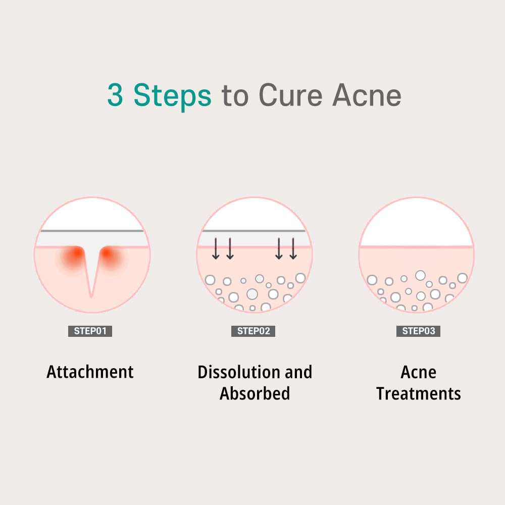 PATCH PRO Micro Pimple Patches with Salicylic Acid - 0.25mm Thin & Invisible Hydrocolloid Bandages for Acne Treatment - 9 Count Pack - Perfect for Overnight Blemish Spot Care & Daily Skincare Routine