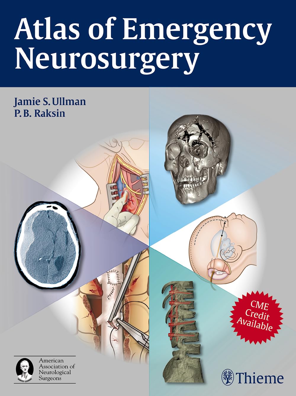 Emergency Neurosurgery Atlas - Comprehensive Guide for Brain & Spine Trauma Procedures | Ideal for Neurosurgeons, ER Doctors & Medical Students