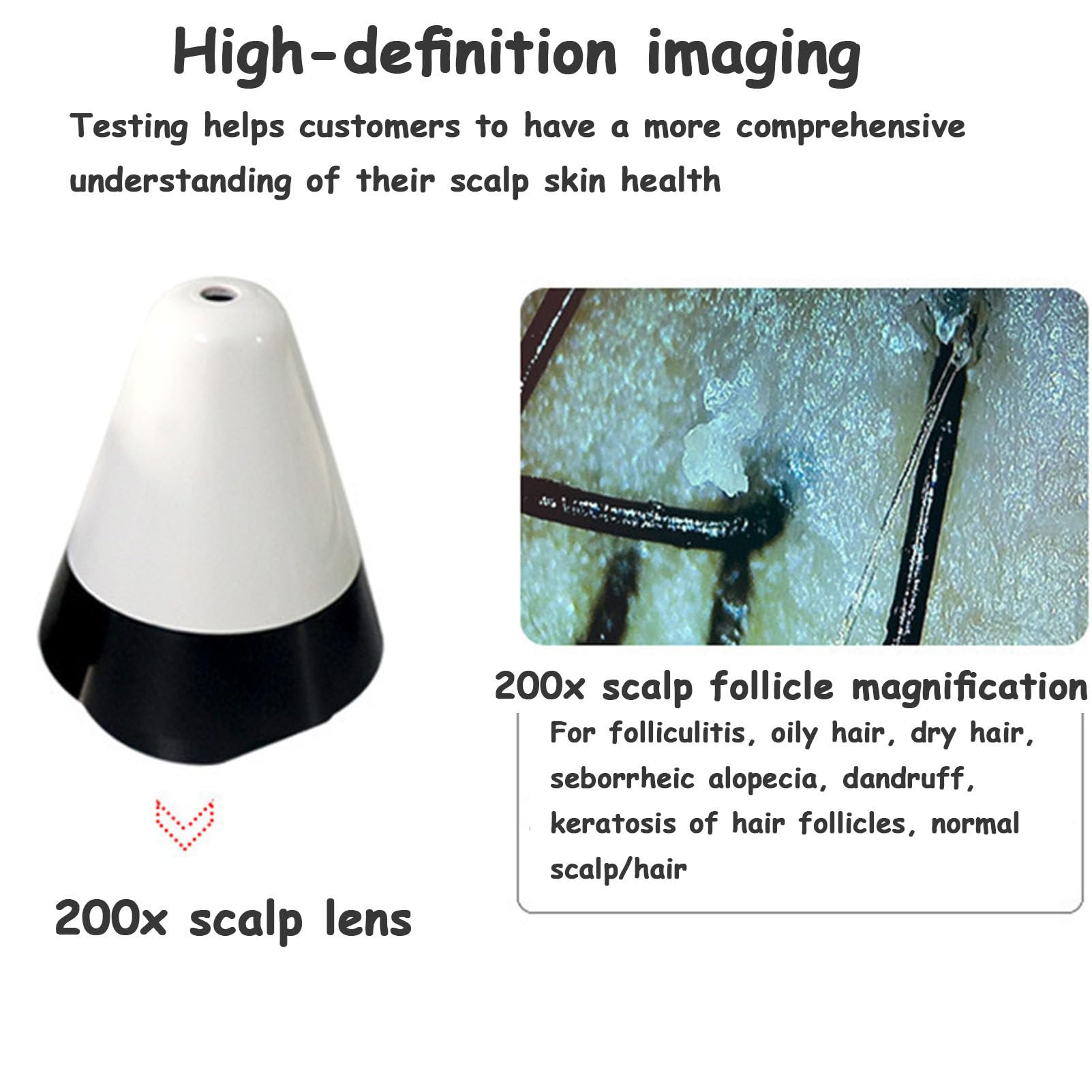 200X USB Digital Microscope Skin Hair Scalp Analyzer - High Resolution Dermatoscope Camera for Acne Treatment, Blackhead Detection & Scalp Analysis | Perfect for Home Skin Care, Beauty Salons & Dermatology Clinics