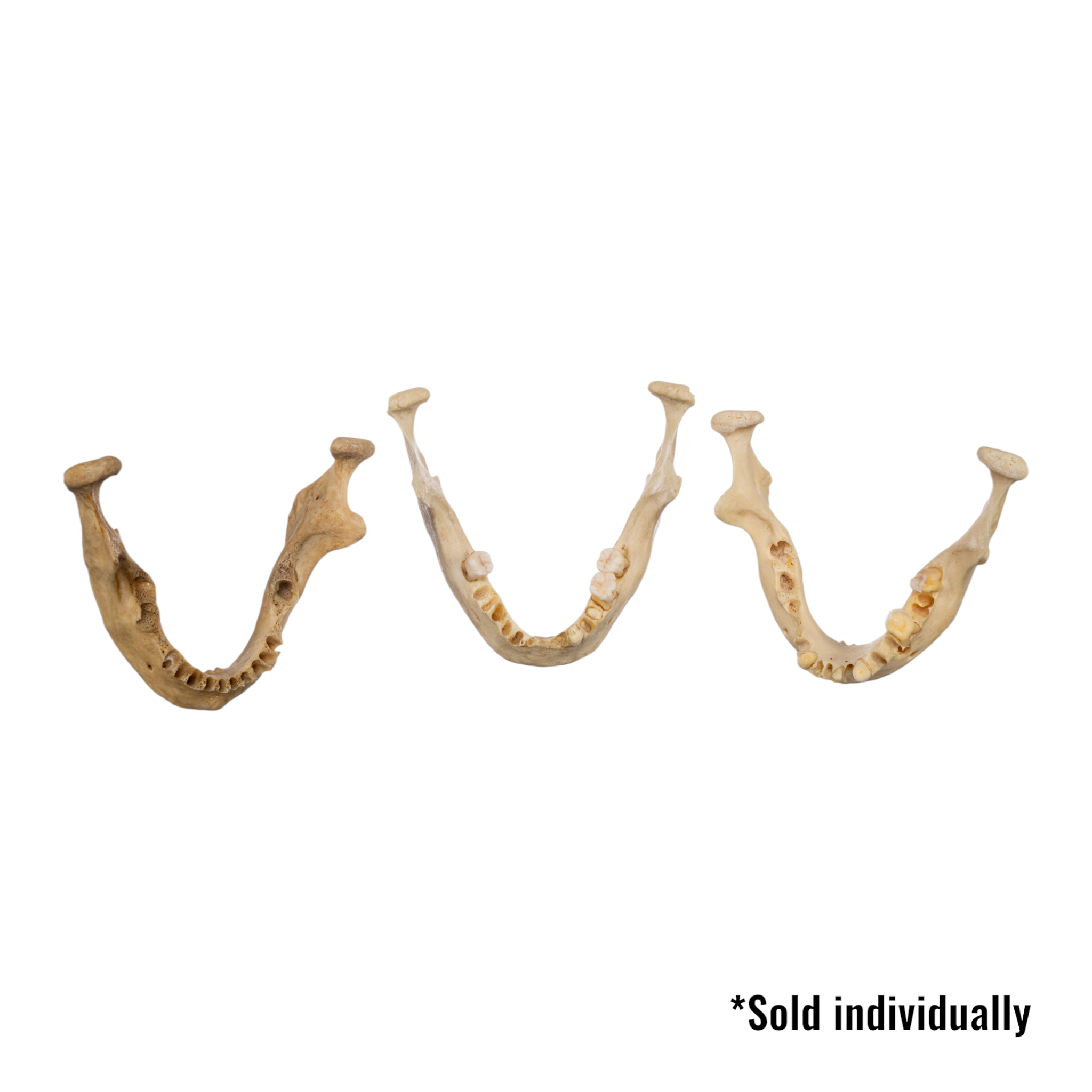 Authentic Human Mandible Bone - Single Specimen for Medical Study, Dental Education & Anatomy Research