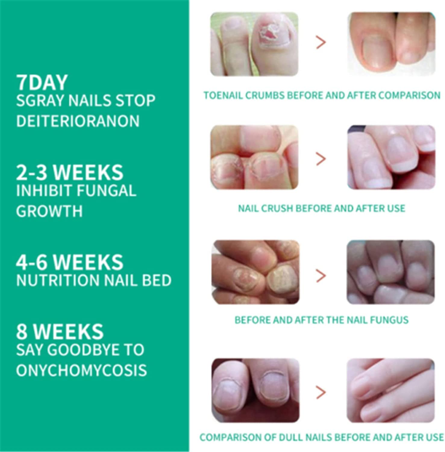Kerassentials Toenail Fungus Treatment Oil - Healthy Skin & Nail Care Solution (3 Pack) - Effective for Athlete's Foot, Nail Fungus & Dry Skin - Perfect for Daily Foot Care Routine