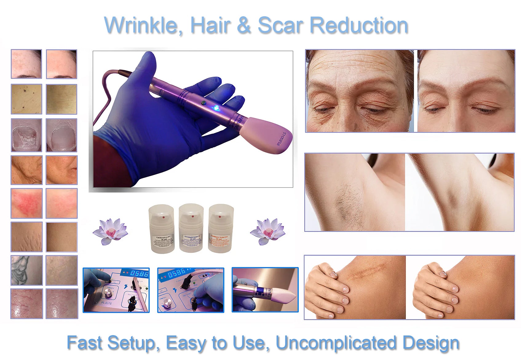 Professional IPL850 LS Large Spot E Light Flux Intense Pulsed Light Hair Removal System - Painless & Effective At-Home Hair Removal for Face, Legs, Bikini Line & Body