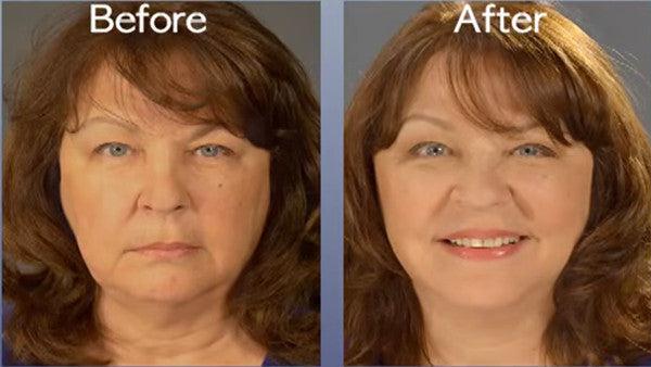 Art Harding Instant Face and Neck Lift - Anti-Aging Skin Tightening Cream for Wrinkles & Sagging Skin | Perfect for Daily Skincare Routine & Special Occasions