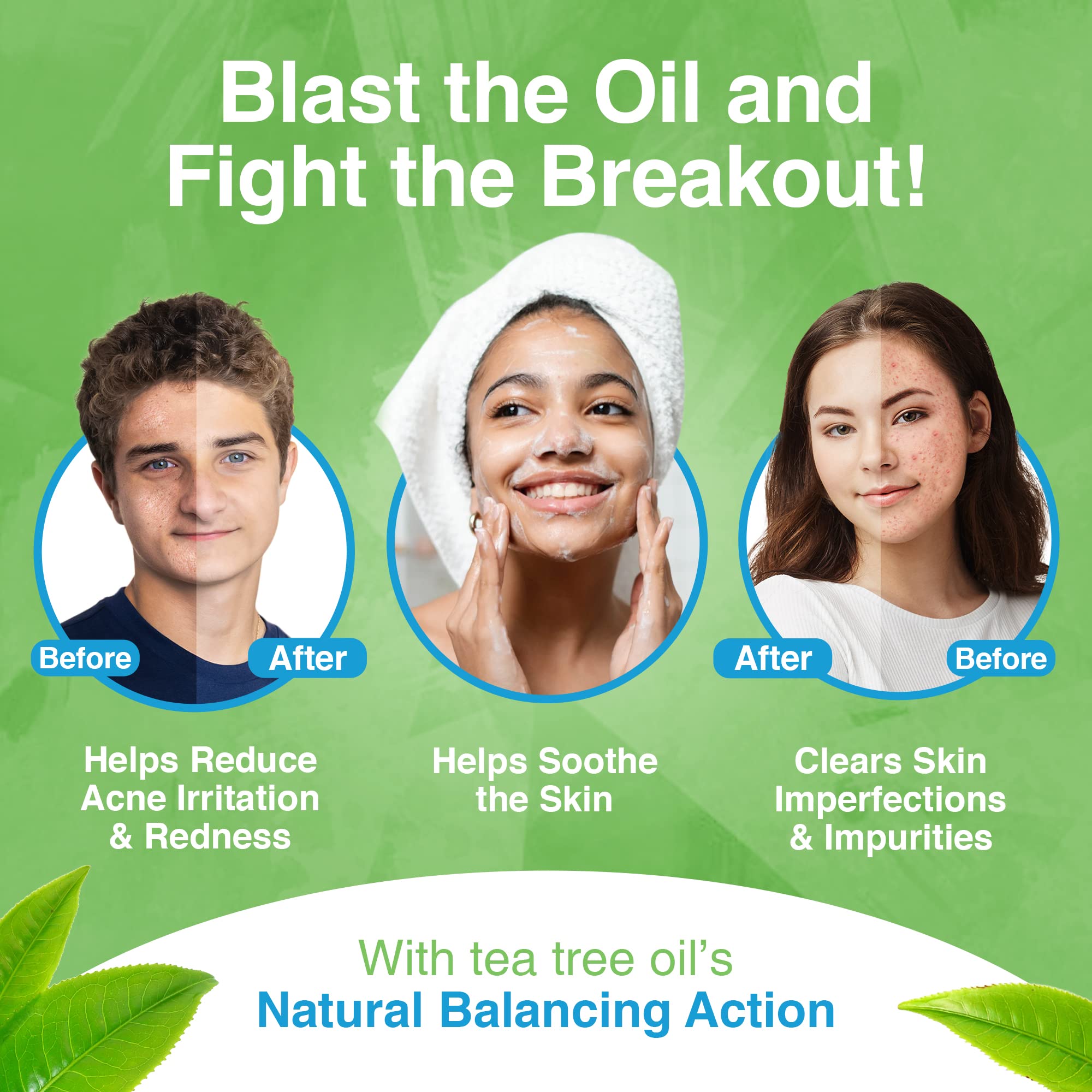 Kidskin T-Blast Facial Cleanser - Gentle Tea Tree Oil Face Wash for Kids & Teens | Natural Acne Treatment for Oily, Dry & Sensitive Skin | 150ml/5oz | Perfect for Daily Skincare Routine & Teenage Acne Care