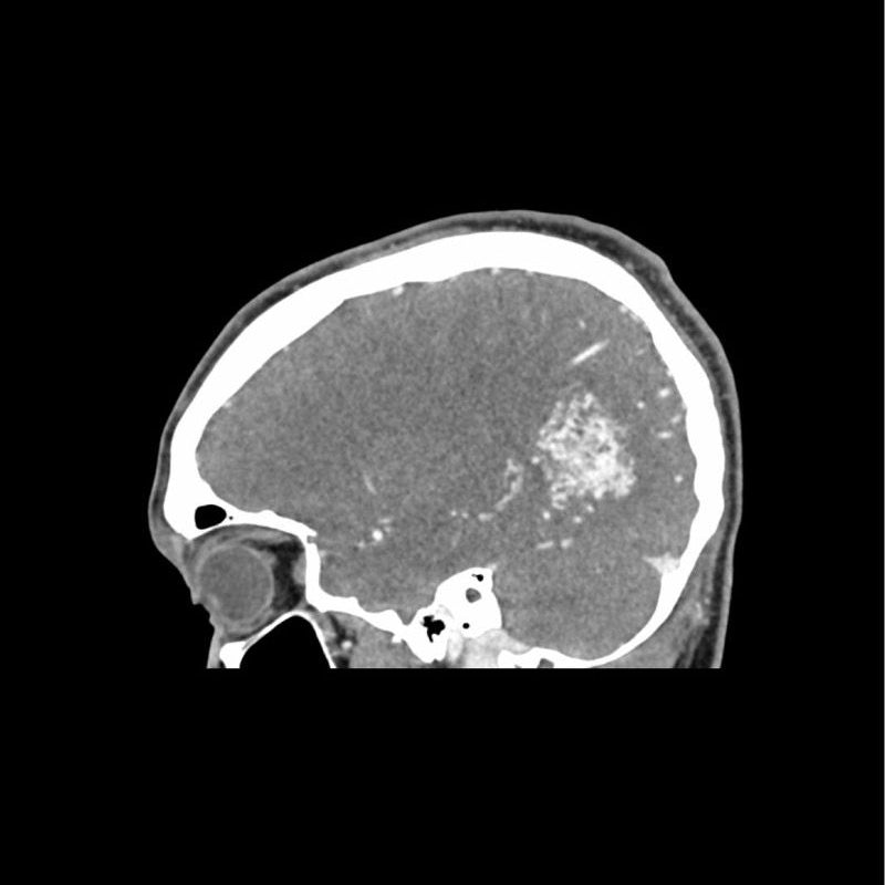 CTA AVM Head Phantom for CT Scan & X-Ray Training - Medical Imaging Practice, Radiology Education & Diagnostic Testing Simulation