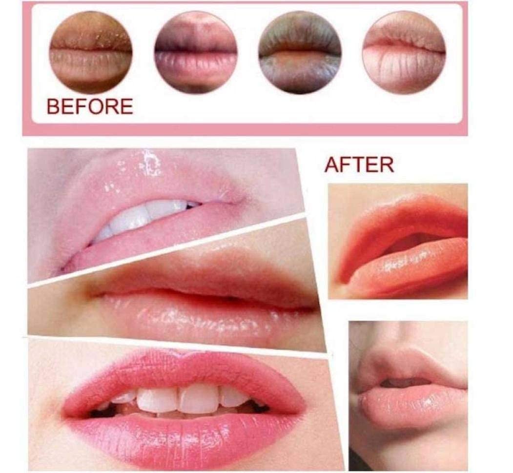Red Cherry Lip Mask - Hydrating Jelly Lip Care Pack of 20 - Perfect for Overnight Treatment & Daily Lip Moisturizing