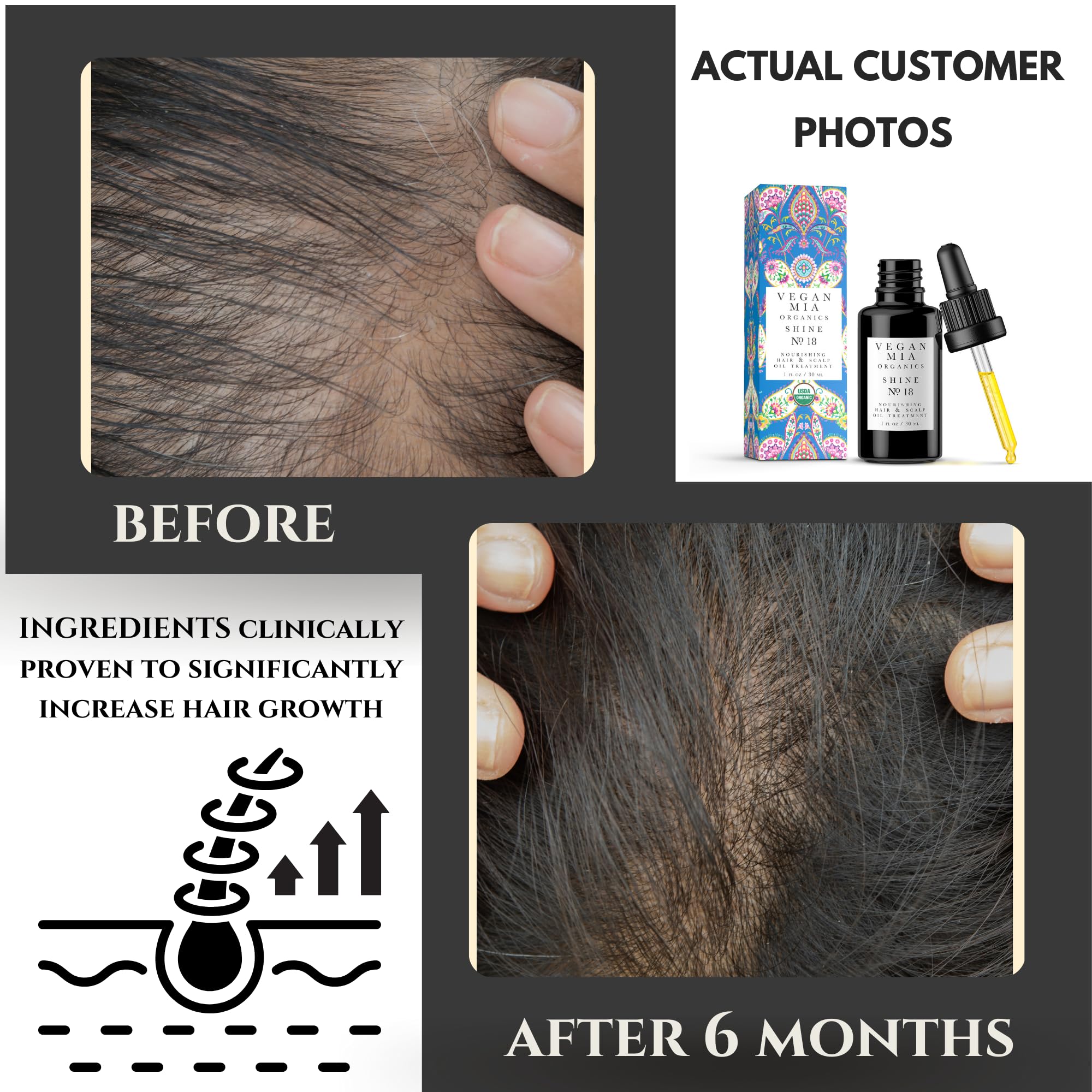 USDA Organic Rosemary Oil for Hair Growth with Castor Oil & Jojoba Oil - Natural Scalp Treatment for Thicker, Healthier & Shiny Hair - 1 fl oz (Pack of 4) - Perfect for Daily Hair Care, Massage & DIY Hair Masks
