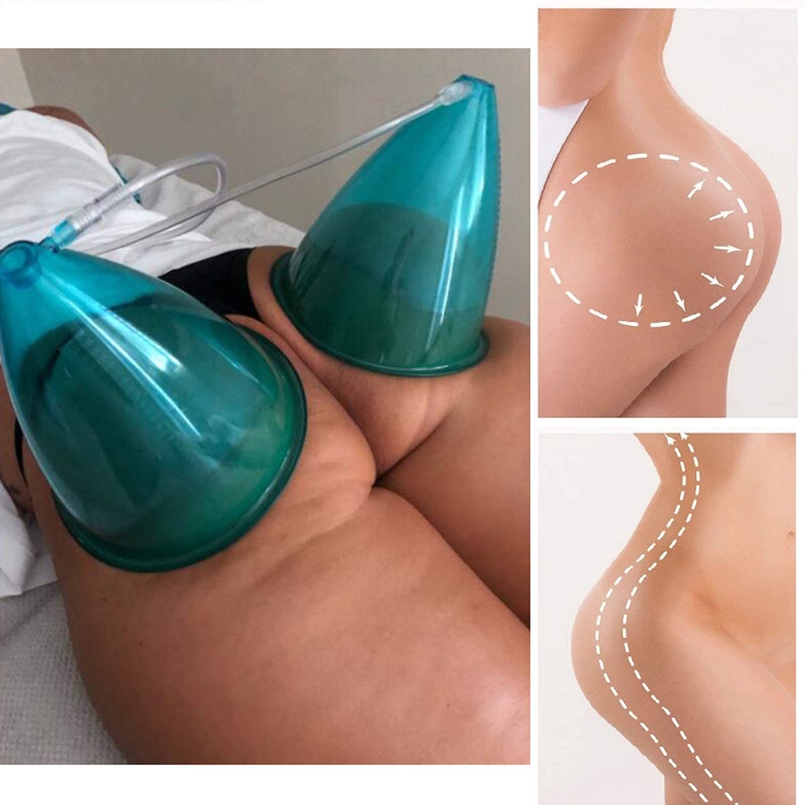 XL Vacuum Cupping Therapy Set for Butt Lift & Body Massage - 160ml & 180ml Silicone Suction Cups - Cellulite Reduction & Muscle Relaxation - Perfect for Home Spa, Post-Workout Recovery & Beauty Treatments