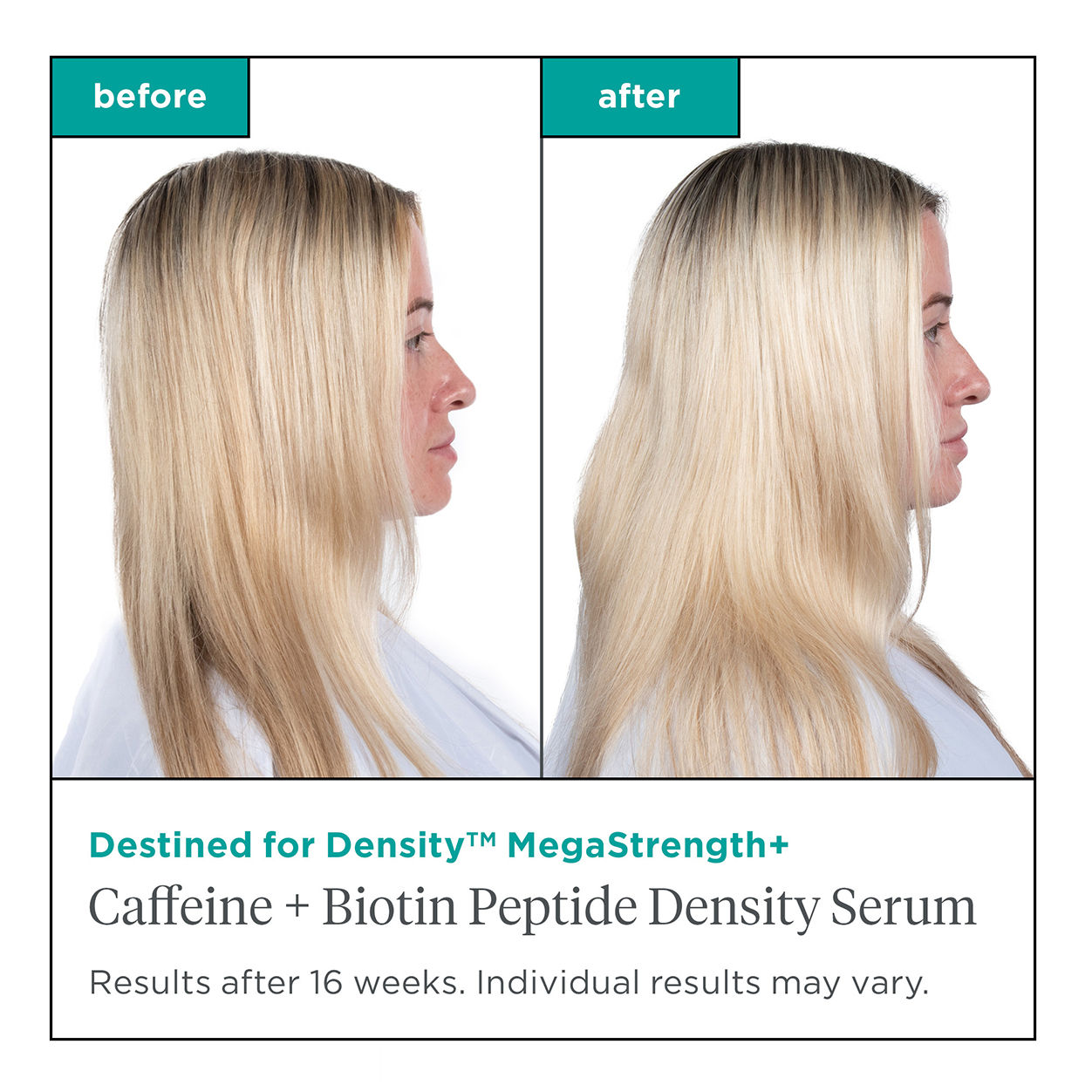 Destined for Density MegaStrength+ Caffeine & Biotin Peptide Hair Growth Serum for Thicker, Fuller Hair - Perfect for Thinning Hair & Scalp Care
