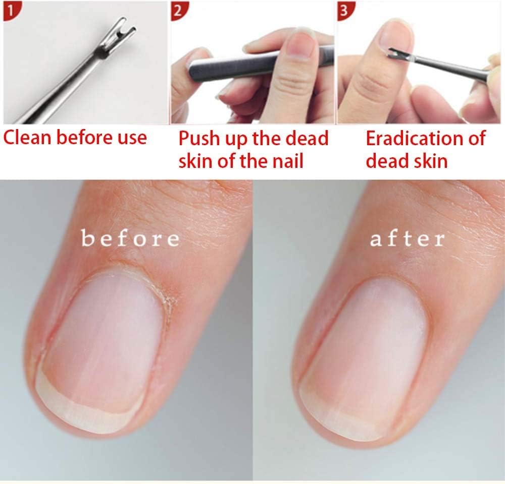 ZAUKY Professional Cuticle Remover & Pusher - Stainless Steel Nail Cleaner with Anti-Slip Grip - Dead Skin Cutter for Manicures & Pedicures - Perfect for Home Nail Care & Salon Use