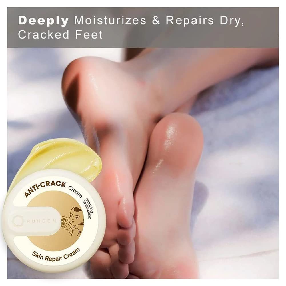 LLYAND Cracked Skin Repair Cream - Intensive Healing for Dry, Cracked Hands & Feet - Anti-Dryness & Crack Prevention - 15g Heel Balm - Perfect for Winter Skin Care & Extreme Dryness Relief