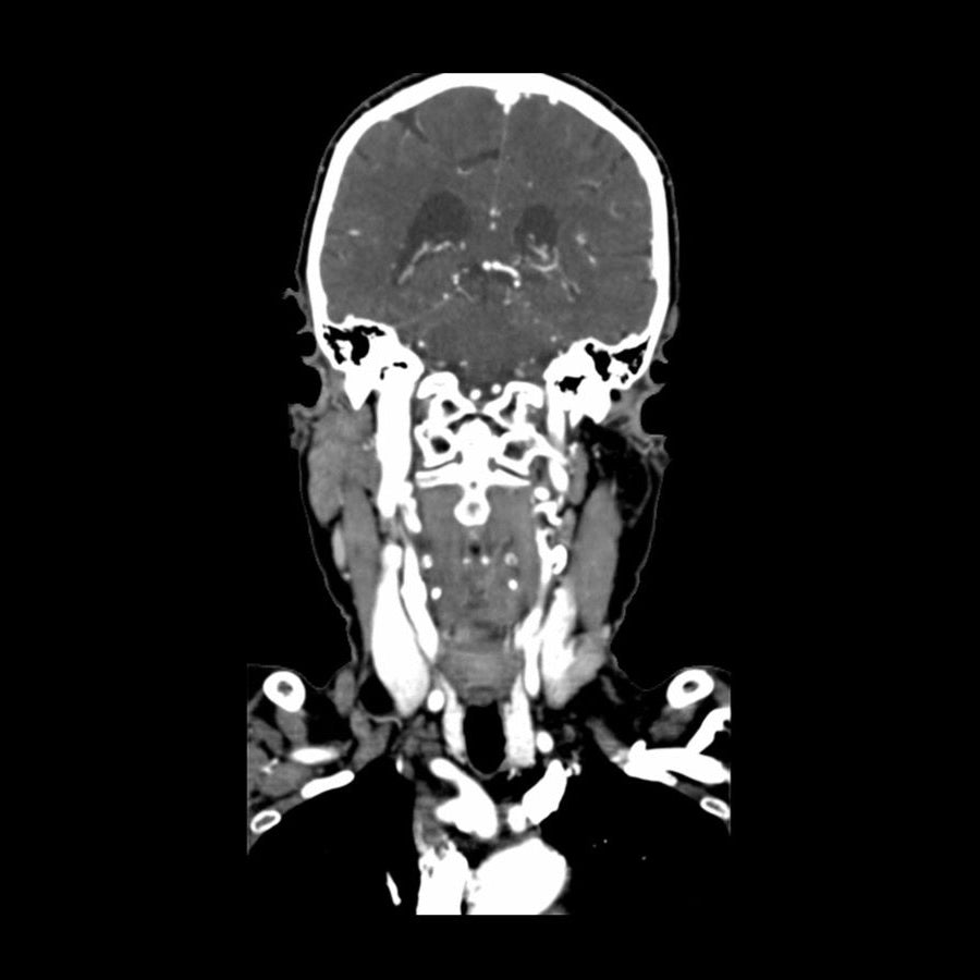 Professional CTA Head and Neck Phantom - High-Quality CT Scan & X-Ray Training Model for Medical Education | Perfect for Radiology Students, Technicians & Clinical Practice