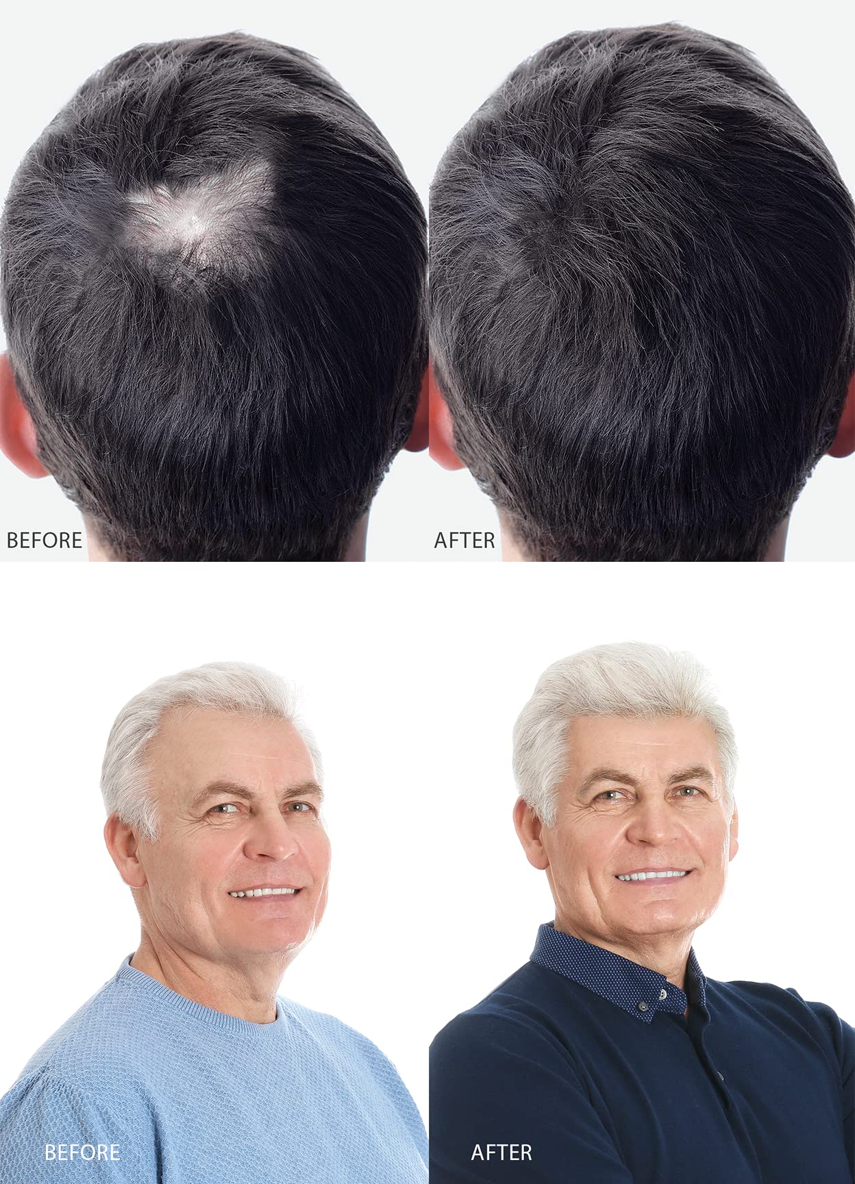 Lifespan Hair Restorer for Men & Women - Natural Hair Growth Treatment for Thinning Hair & Baldness - Best Hair Regrowth Serum for Daily Use at Home & Salon
