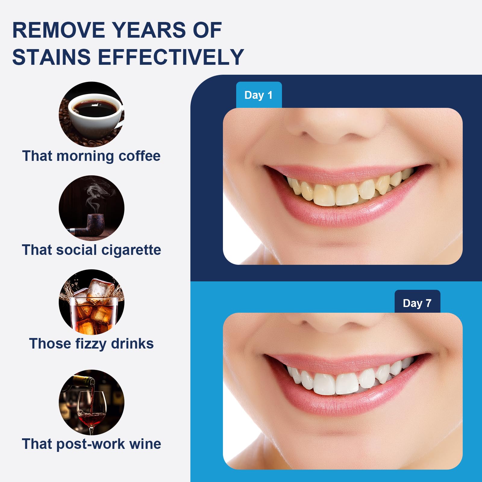 Professional Teeth Whitening Strips - 42 Whitening Strips for 21 Sessions, Safe for Enamel with Mouth Opener Included | Brighten Your Smile for Weddings, Job Interviews & Special Occasions