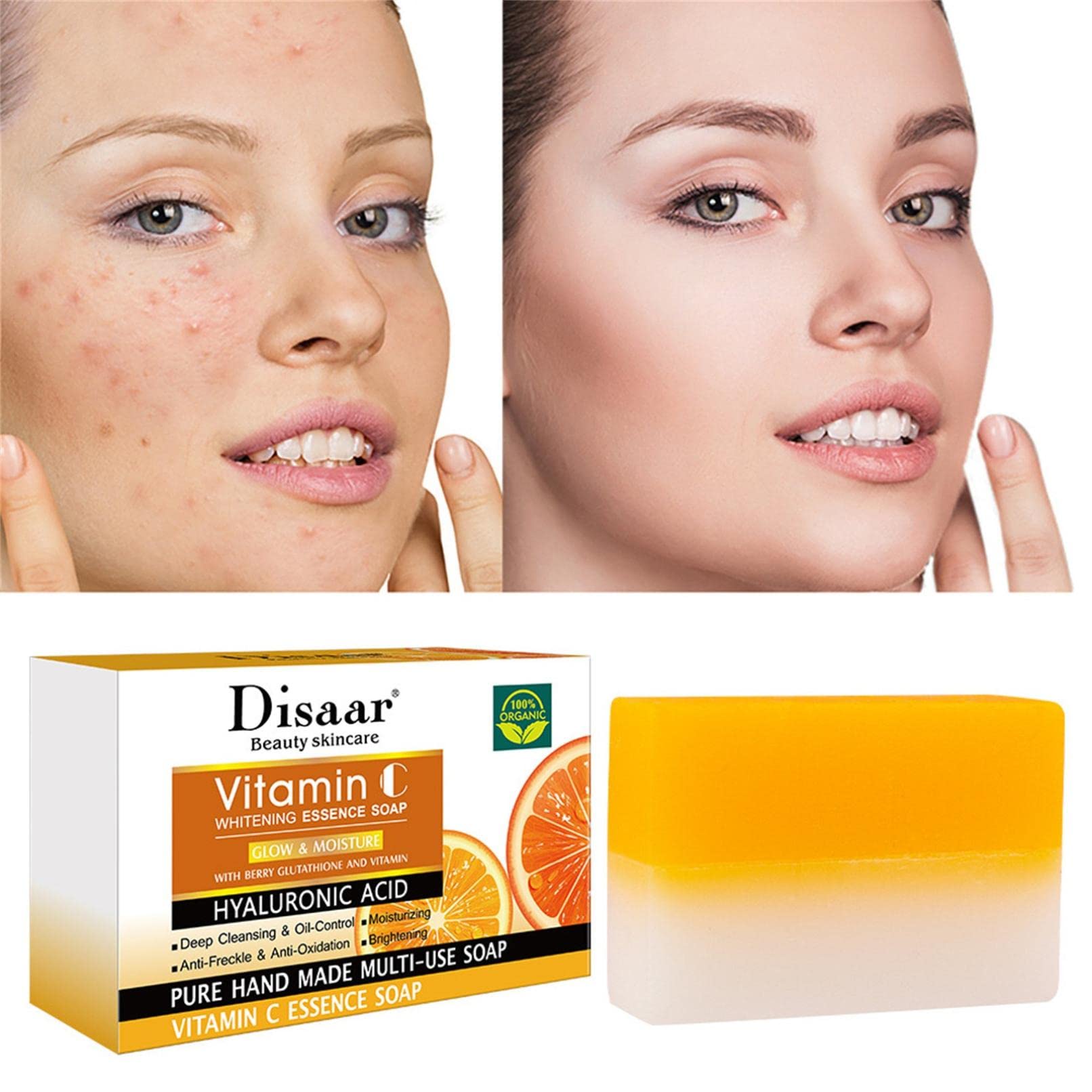 Handmade Two-Tone Vitamin C Facial Cleansing Soap - Brightening, Moisturizing & Anti-Aging Skincare for Even Skin Tone | Perfect for Daily Face Wash & Acne Treatment