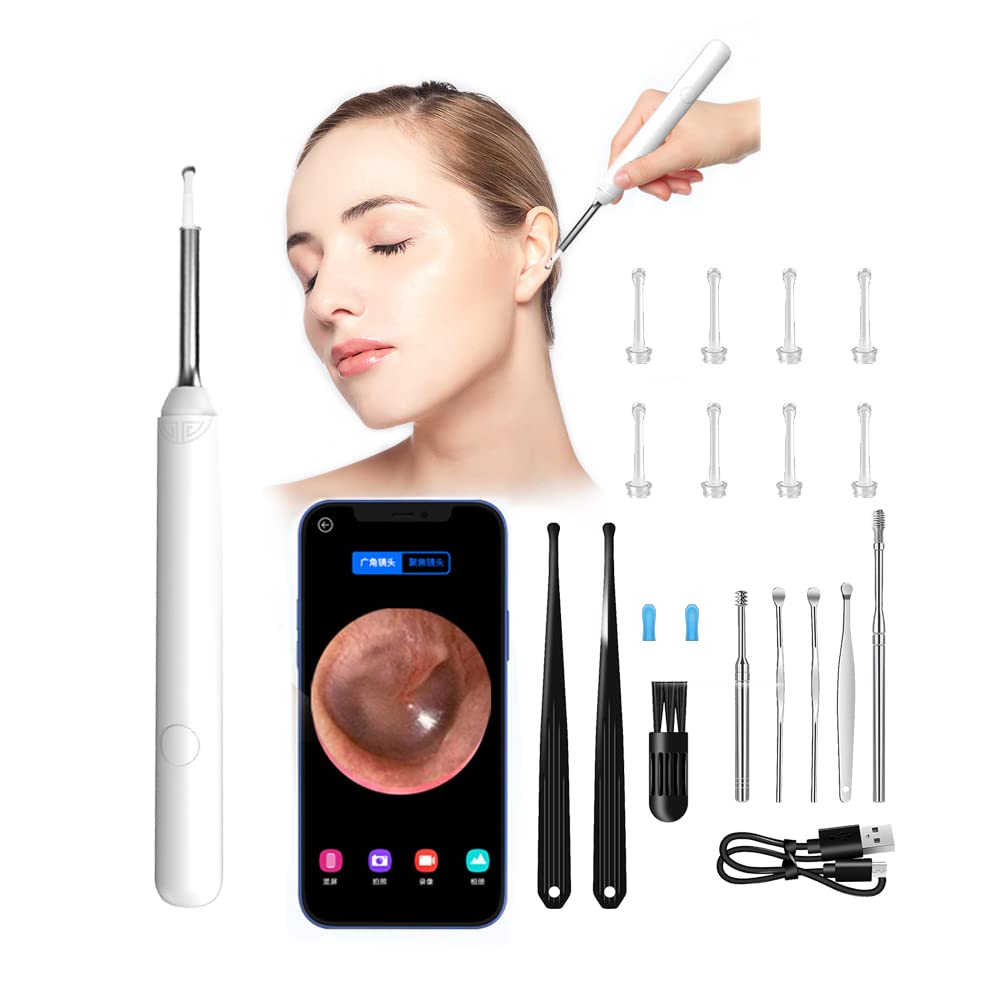 Ear Wax Removal Tool with 1080P HD Camera - Ear Cleaning Otoscope Kit with Light for iOS & Android - Safe Earwax Remover for Adults & Kids - Perfect for Home Use & Travel (White)