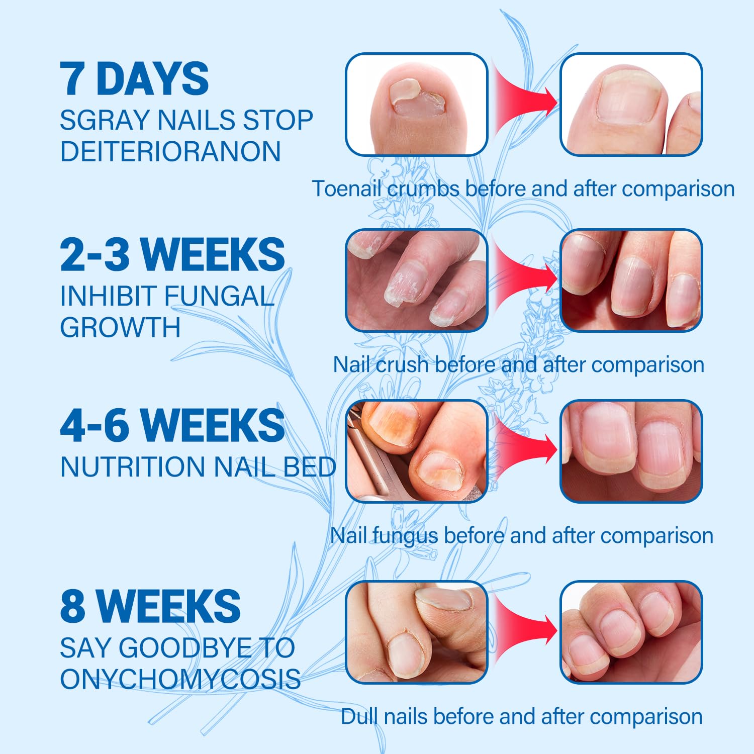 Extra Strength OMO Toenail Fungus Treatment for Toenails & Fingernails - 30ML Natural Nail Repair Liquid - Safe & Gentle Solution for Fungal Infections - Perfect for Athletes, Swimmers & Active Lifestyles