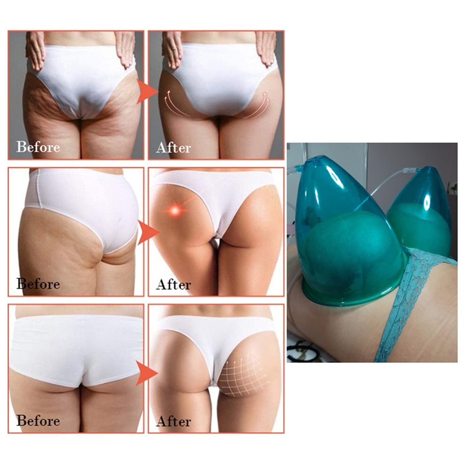 180ML Extra Large Vacuum Cupping Cups for Body Massage - 2 Pack, Hip Lift & Pain Relief Therapy Tools for Home Spa, Back Pain, Cellulite Treatment