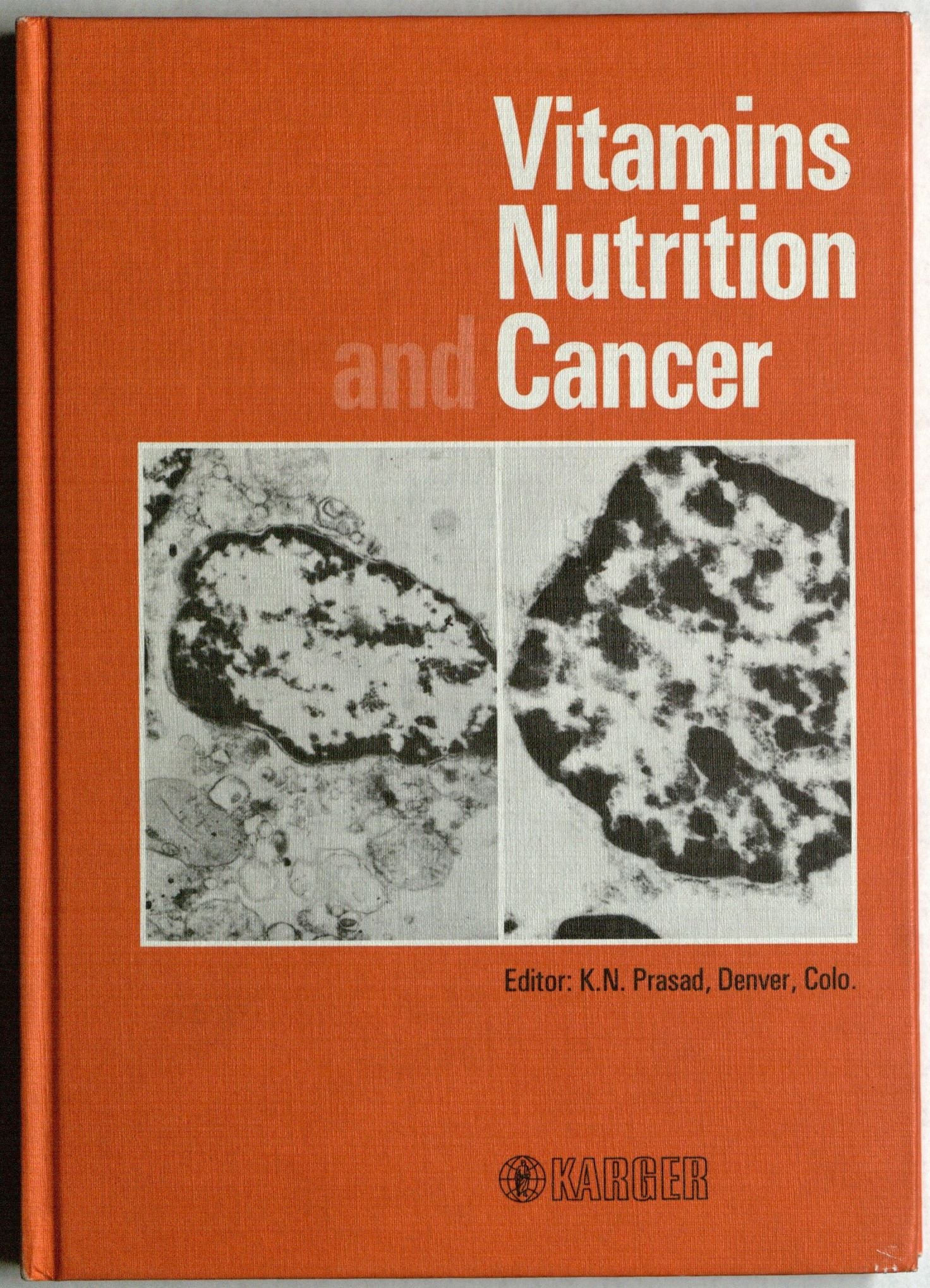 Best Vitamins & Nutrition Supplements for Cancer Patients - Immune Support & Recovery - Ideal for Chemotherapy & Daily Wellness