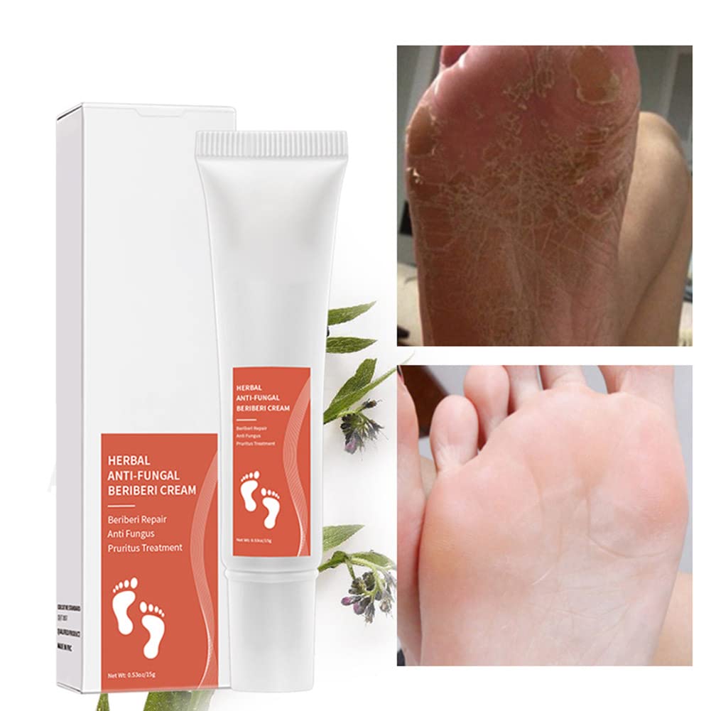 Allbesta Herbal Anti-Fungal Foot Cream - Treats Foot Infections, Reduces Inflammation & Relieves Itching - Effective for Athlete's Foot, Ringworm & Nail Fungus - Perfect for Daily Foot Care & Post-Workout Recovery