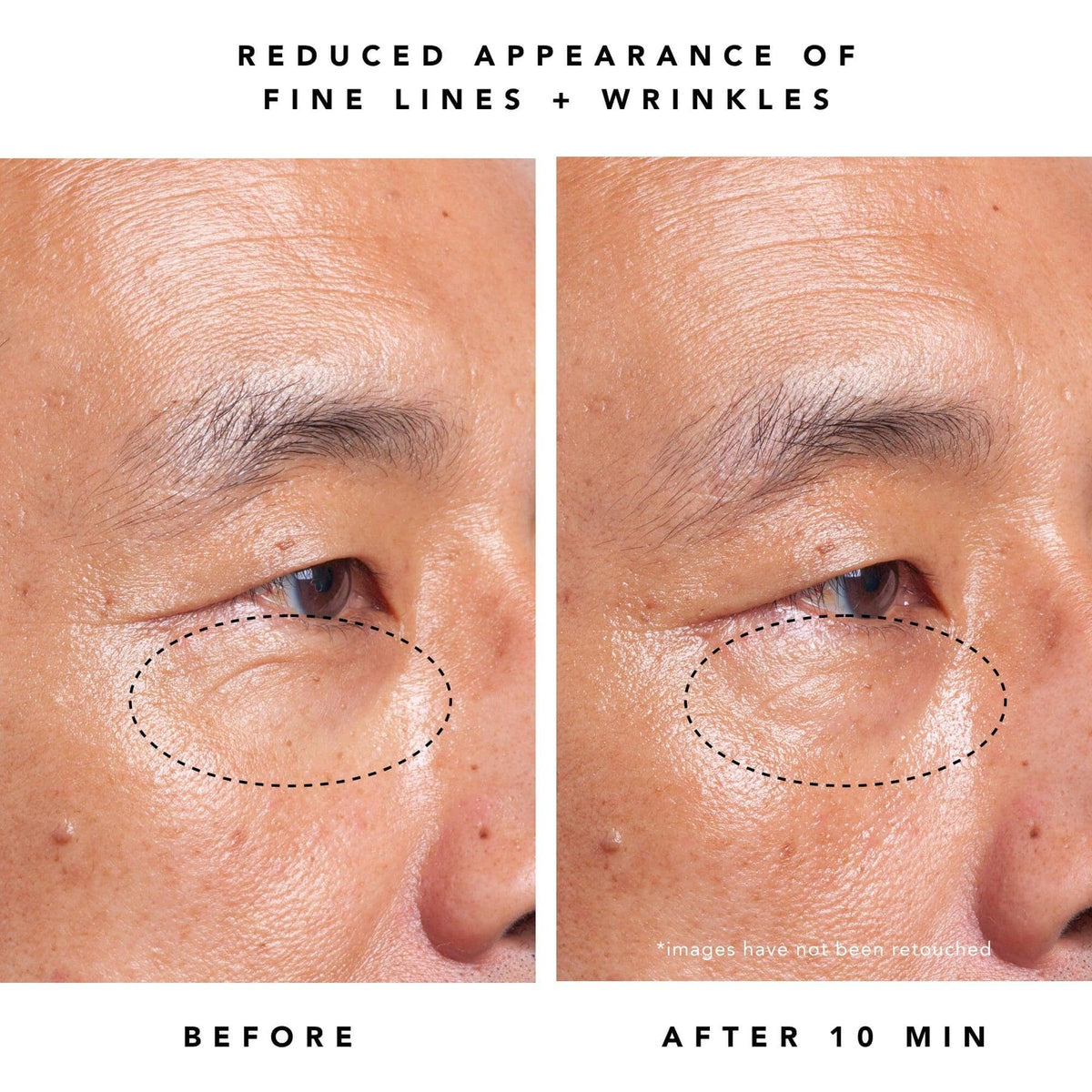 Moon Dew 1% Bakuchiol & Peptides Anti-Aging Eye Cream - Natural Retinol Alternative for Dark Circles & Wrinkles - Perfect for Nighttime Skincare Routine