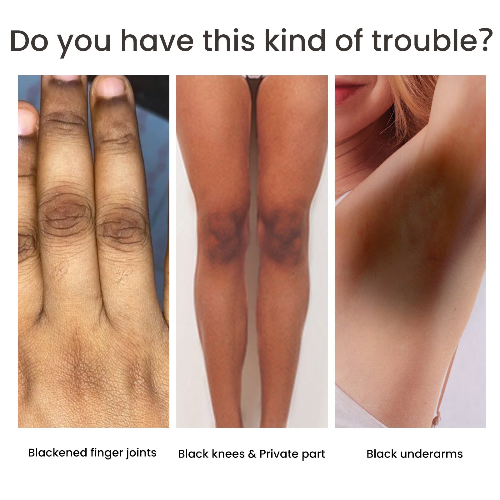 Best Women's Skin Pigmentation Treatment Cream - Brightening & Even Tone for Dark Spots & Hyperpigmentation - Perfect for Daily Skincare Routine & Post-Acne Care