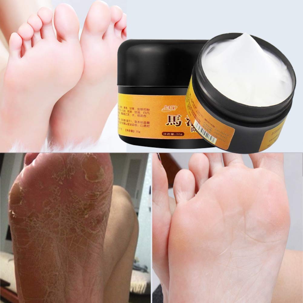 Allbestaye Horse Oil Foot Cream for Dry Cracked Heels - Intensive Repairing Moisturizer for Rough & Chapped Feet - Best for Cracked Heel Treatment & Foot Care at Night