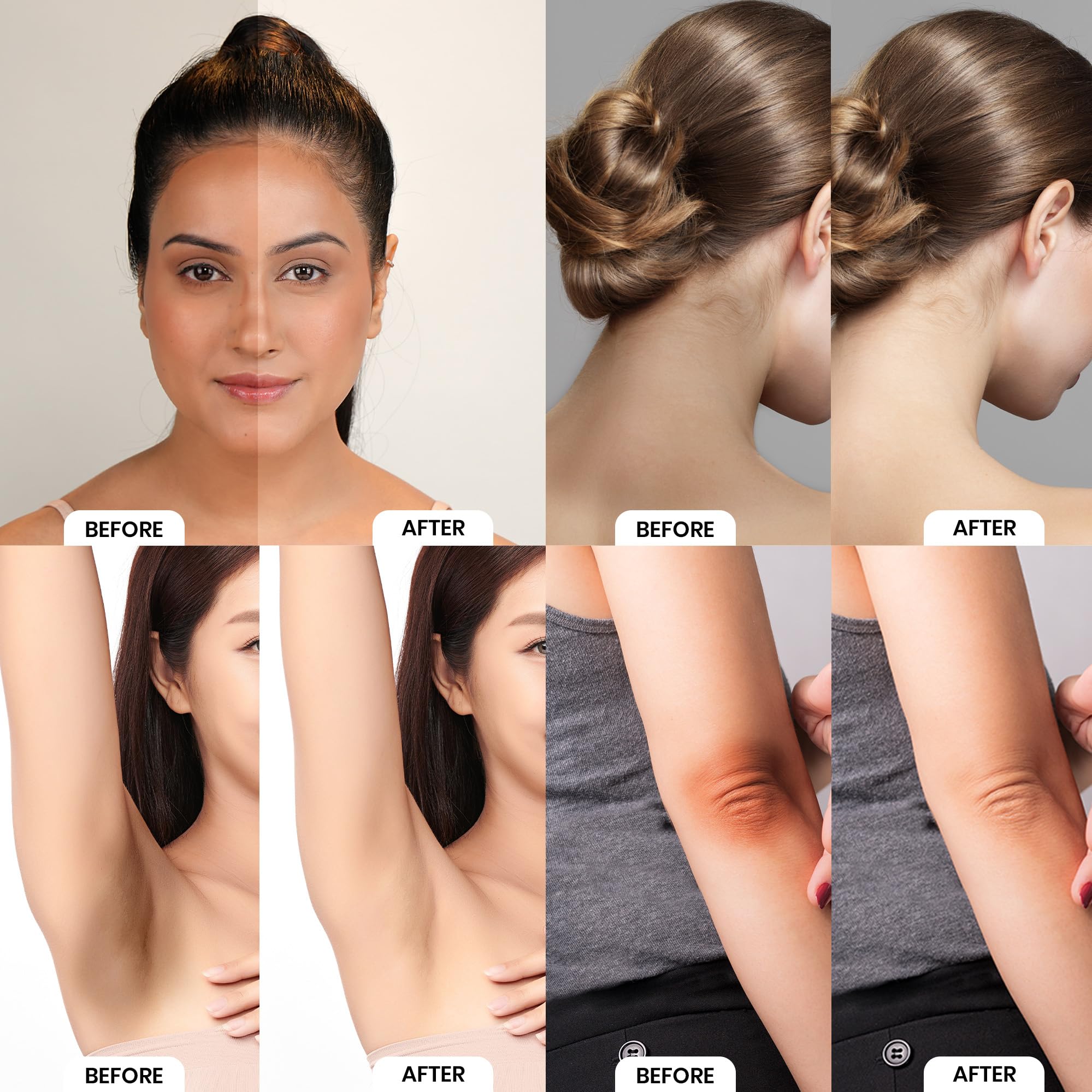 Colors Queen Intimate & Body Whitening Cream with Niacinamide & Hyaluronic Acid - Skin Brightening, Moisturizing Treatment for Neck, Underarms, Bikini Area & Legs | Perfect for Even Skin Tone & Confidence Boost in Summer Dresses & Swimwear