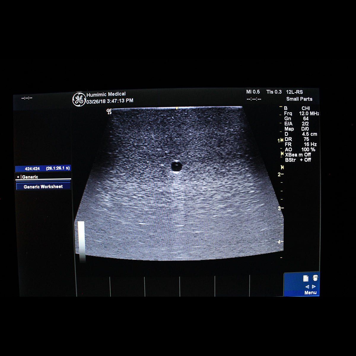 HM VH300 3 Vessel Ultrasound Phantom Trainer - High-Quality Medical Training Device for Sonography Practice, Vascular Imaging & Diagnostic Skills Development | Perfect for Ultrasound Tech Students, Radiology Labs & Clinical Education