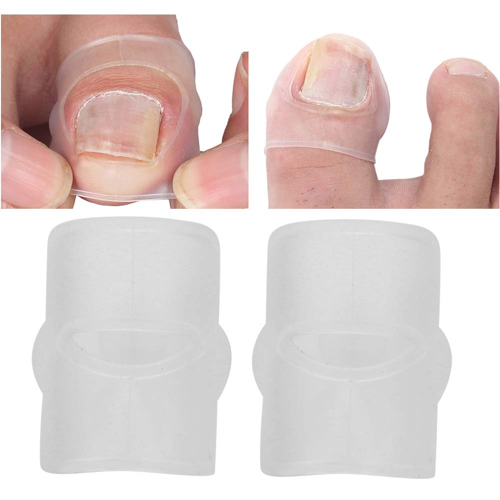 2 Pack Silicone Ingrown Toenail Corrector Tool - Pain Relief & Paronychia Treatment for Ingrown Toenails - Pedicure Care Kit for Toenail Correction - Perfect for Home Use & Professional Pedicures