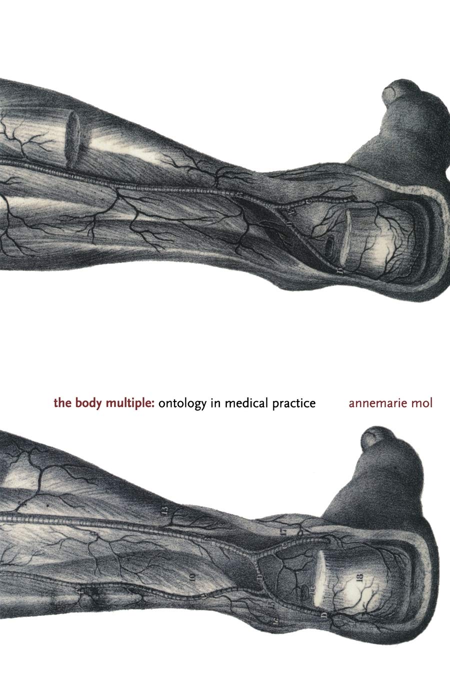 The Body Multiple: Ontology in Medical Practice - Science and Cultural Theory Book | Explore Medical Philosophy & Healthcare Theories for Students & Professionals