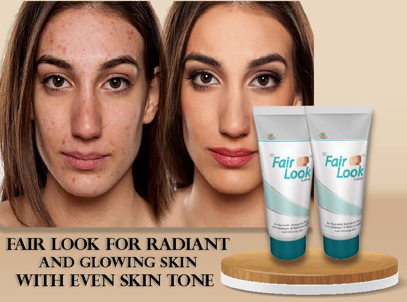 Fair Look Fairness Lotion - Skin Brightening & Even Tone Moisturizer for Glowing Complexion | Daily Use for Face & Body | Perfect for Dry & Dull Skin Care Routine