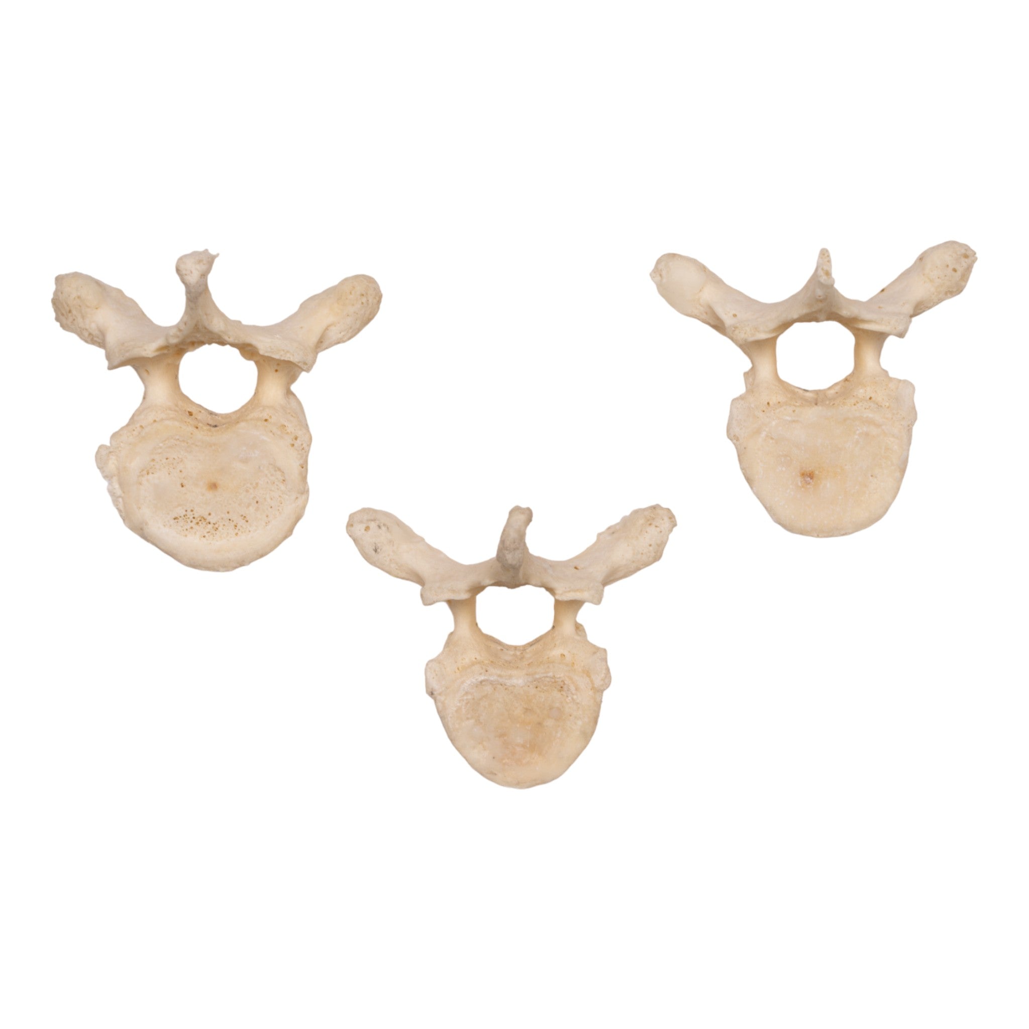 Authentic Human Thoracic Vertebra - Single Bone Specimen for Medical Study, Anatomy Education & Research