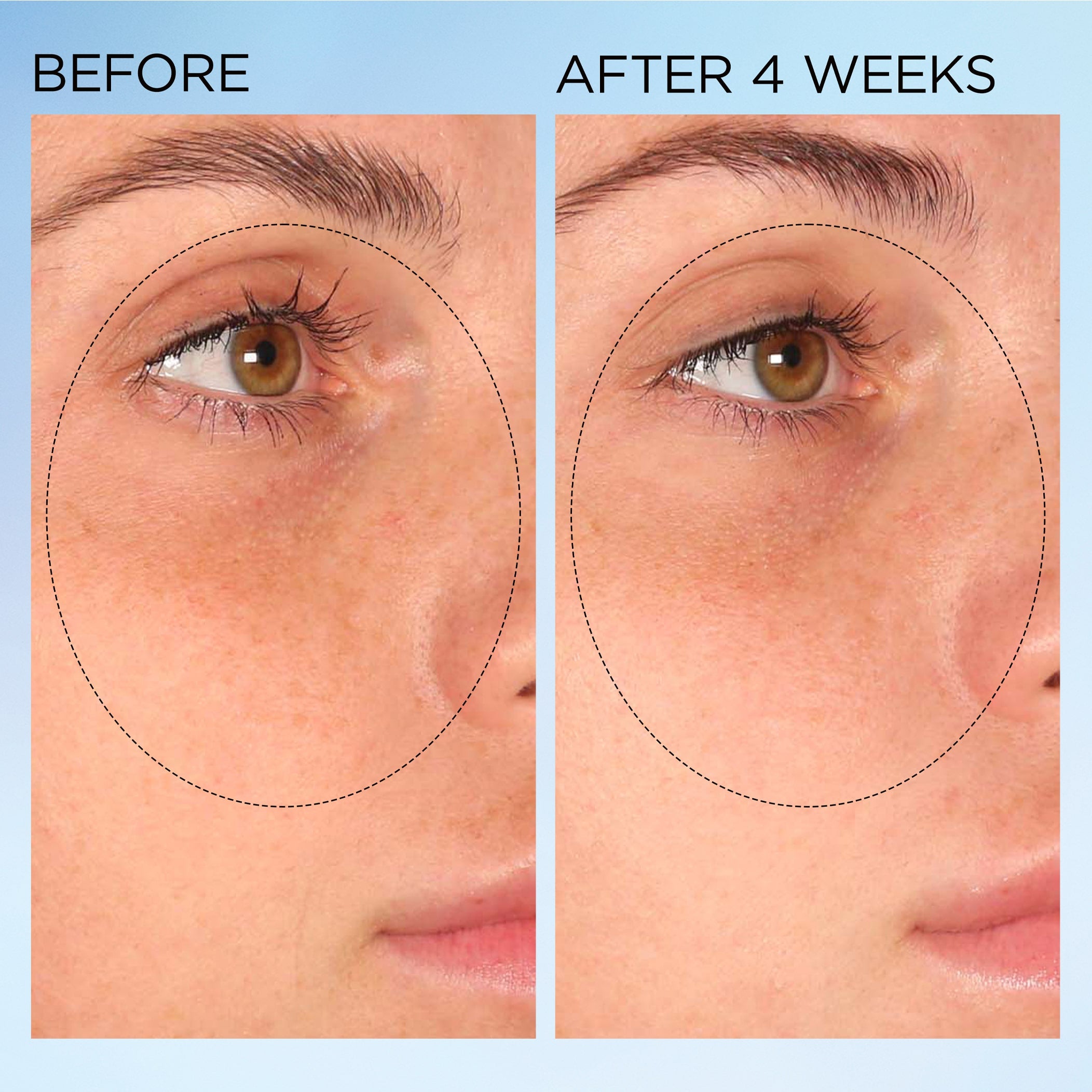 Visible Brightening Clearly Radiant Spot Correcting Capsules 120 Count - Dark Spot Treatment for Face & Body, Brightening Serum for Even Skin Tone - Perfect for Daily Skincare Routine & Nighttime Use
