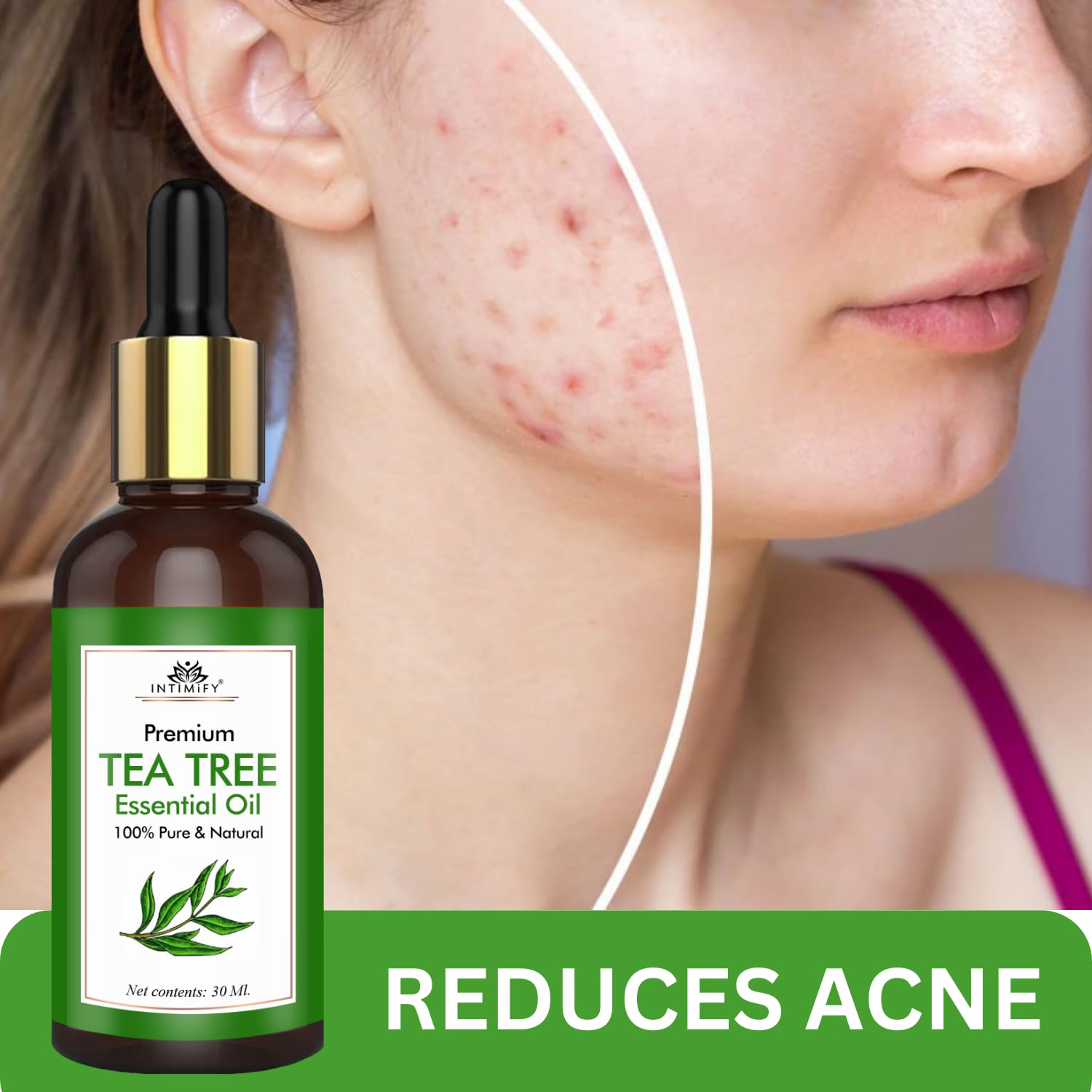 INTIMIFY 100% Pure Tea Tree Essential Oil for Hair Growth, Acne Treatment & Skin Care | Natural Aromatherapy for Women & Men | 30ml (1 Pack) | Perfect for DIY Beauty, Scalp Massage & Relaxation