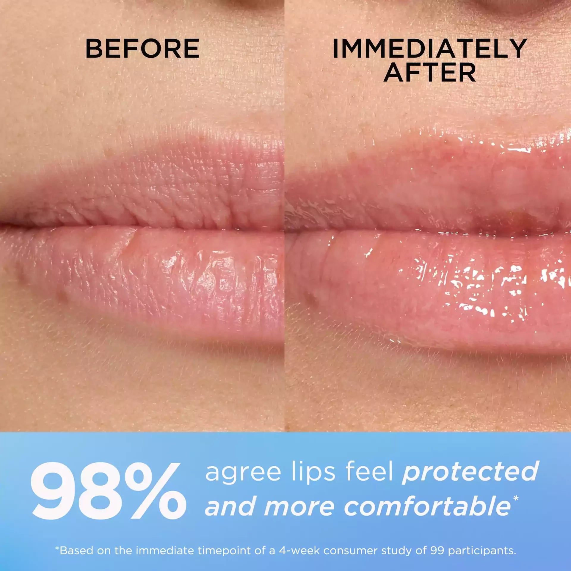 Eight Hour Cream Intensive Lip Repair Balm - Hydrating & Soothing Lip Treatment for Dry, Chapped Lips - Perfect for Winter, Travel & Daily Use