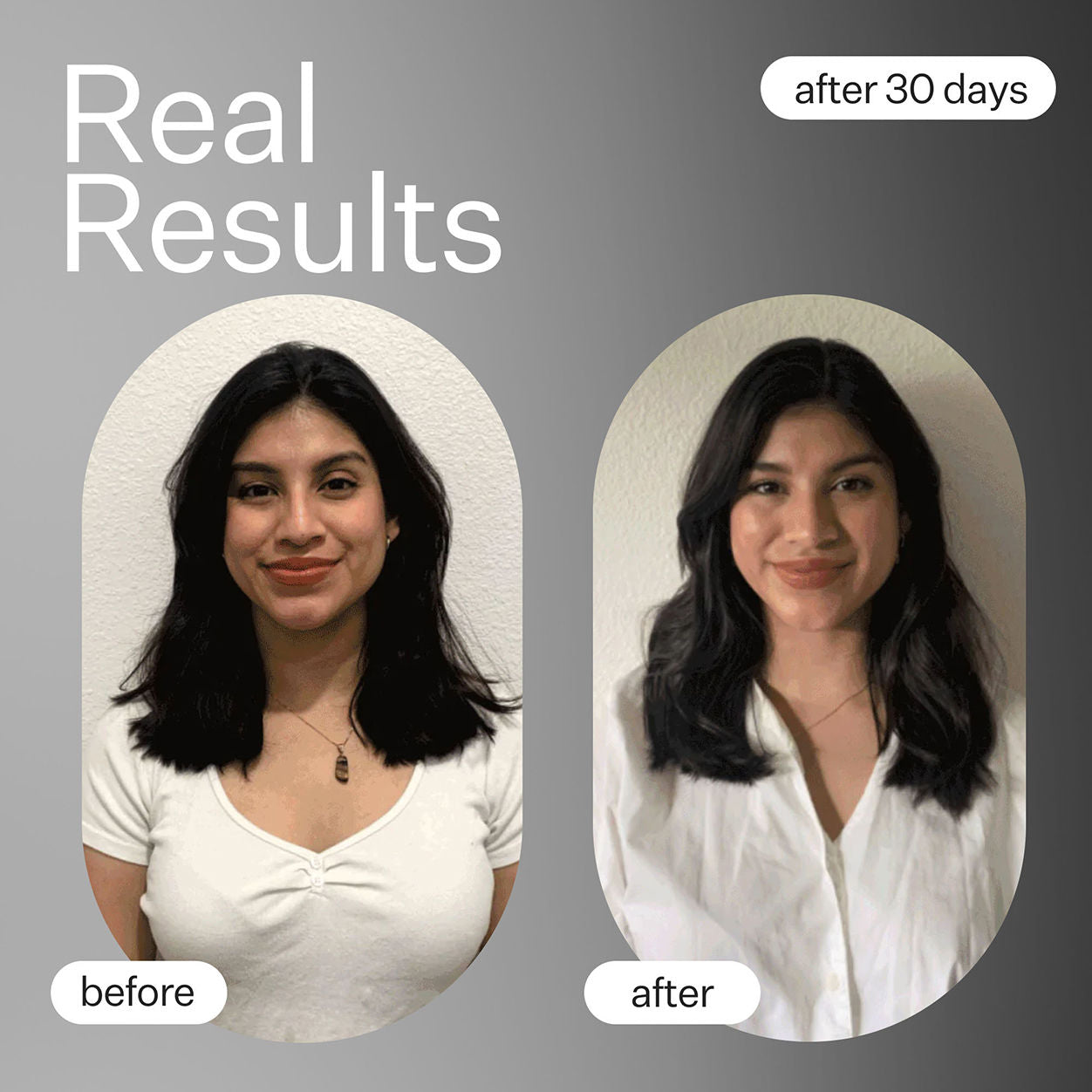 Natural Cold Processed Plant-Based Hair Growth Capsules for Thicker, Stronger Hair - Supports Healthy Hair Growth for Men & Women