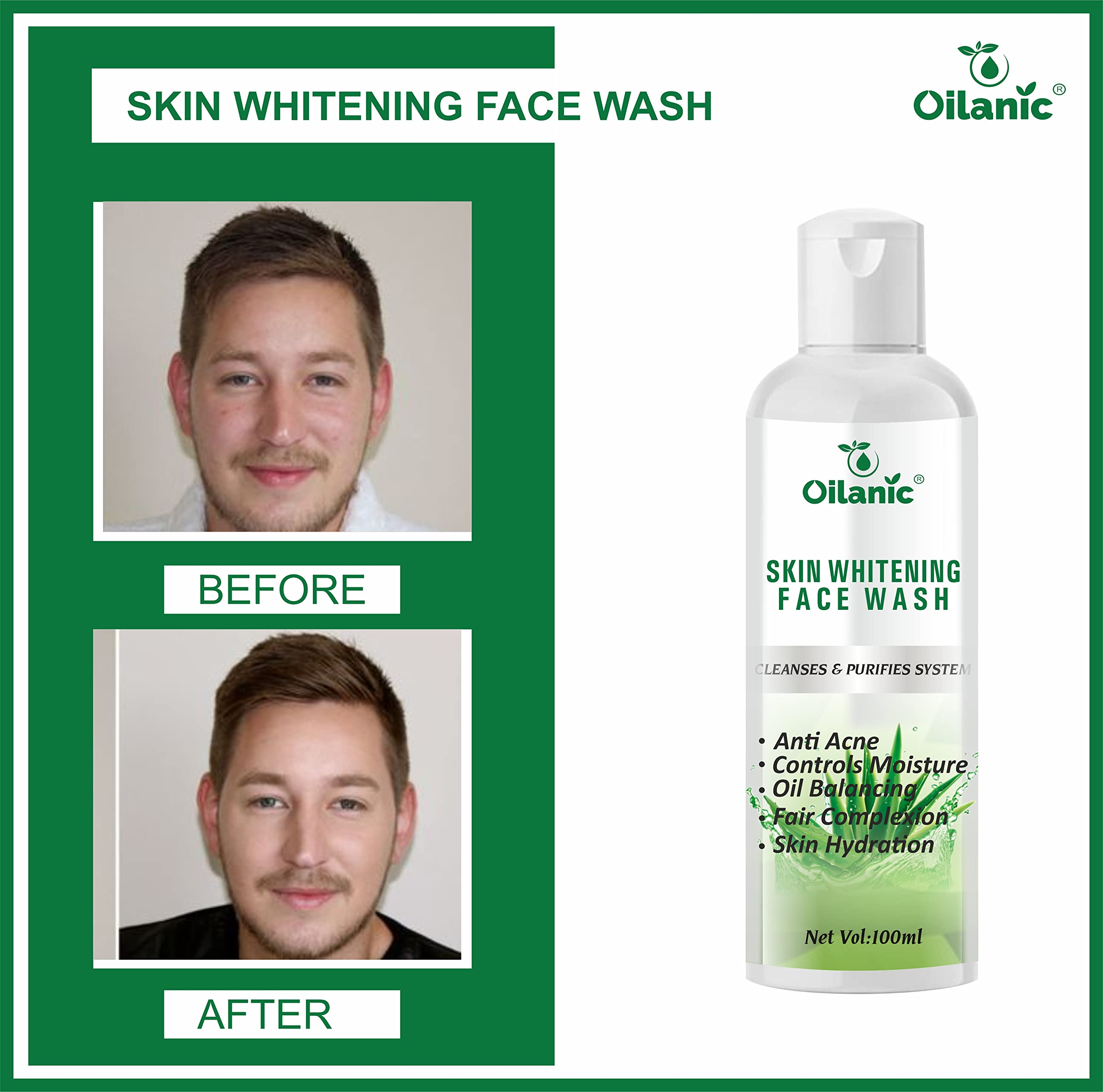 Oilanic Men's Brightening Face Wash - Acne & Scar Treatment, Sunburn & Dark Spot Remover - 100ml | Daily Skincare for Clear & Even Skin Tone