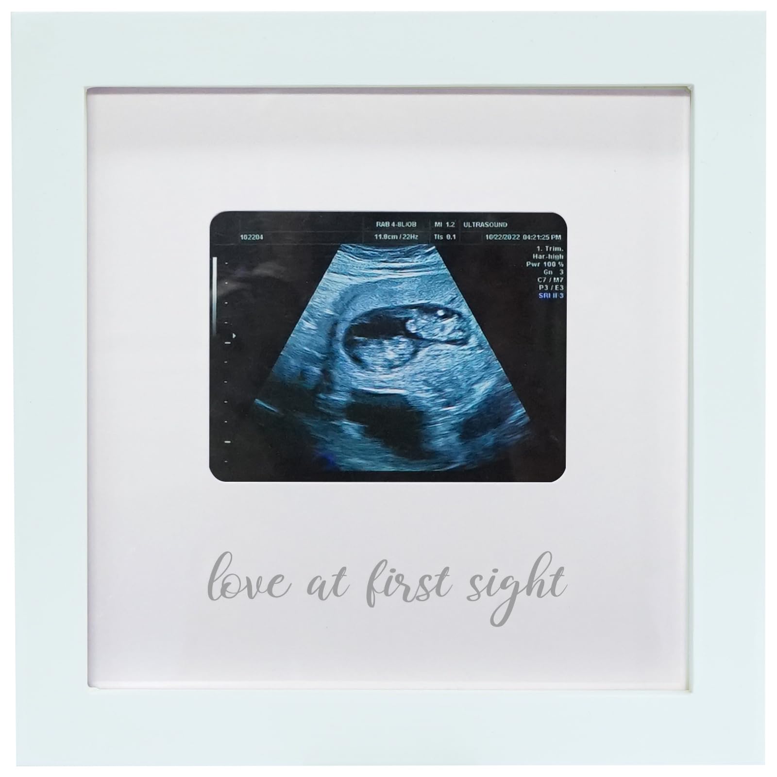 Ultrasound Picture Frame - Pregnancy Announcement Gift for Grandparents | Nursery Décor
