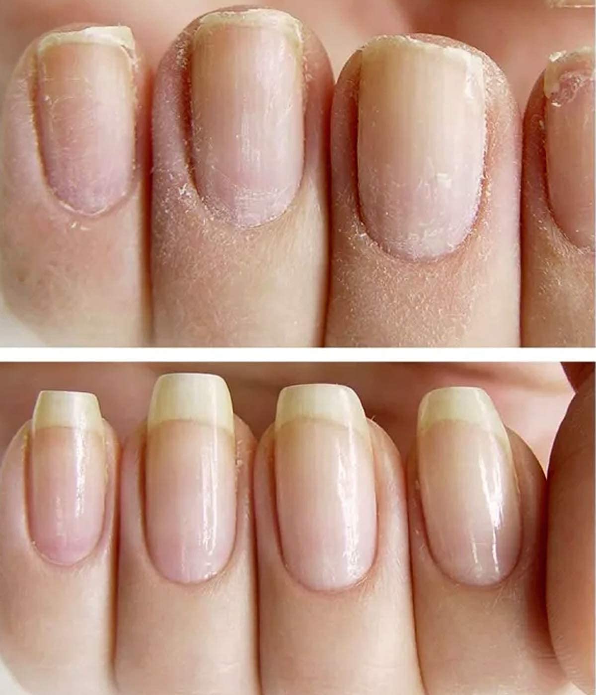 NAILVIVE Nail Strengthening Serum with Natural Keratin & Silk Proteins - Hardens & Repairs Weak, Brittle Nails - Prevents Splitting, Chipping, Peeling & Cracking - Perfect for Salon-Quality Nails at Home or Professional Use