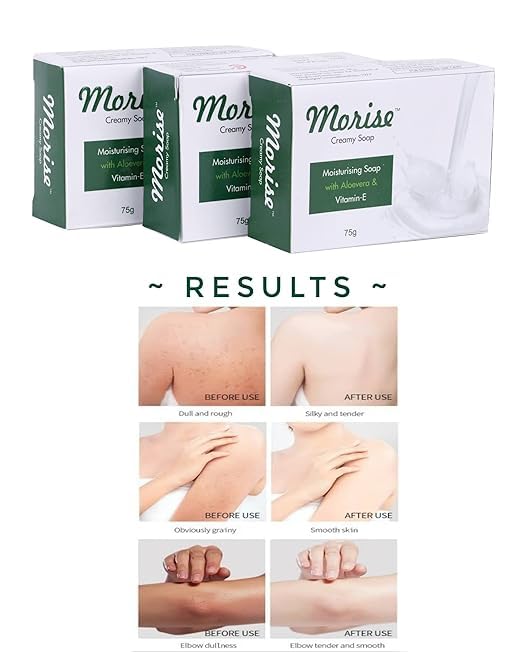 Morise Creamy Aloe & Vitamin E Face Soap - Deep Moisturizing Cleanser for Soft, Smooth & Glowing Skin | Gentle Daily Facial Wash for Dry, Sensitive & Acne-Prone Skin | Perfect for Morning & Night Skincare Routine
