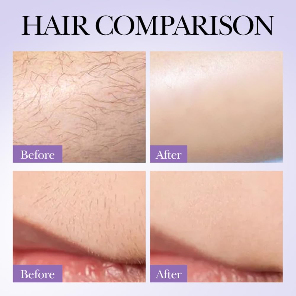 Hair Inhibitor Spray for Face, Underarms & Legs - Soothing Hair Growth Inhibitor for Women & Men - Post Wax Care Solution | Reduce Unwanted Hair Growth for Smooth Skin at Home & Salon