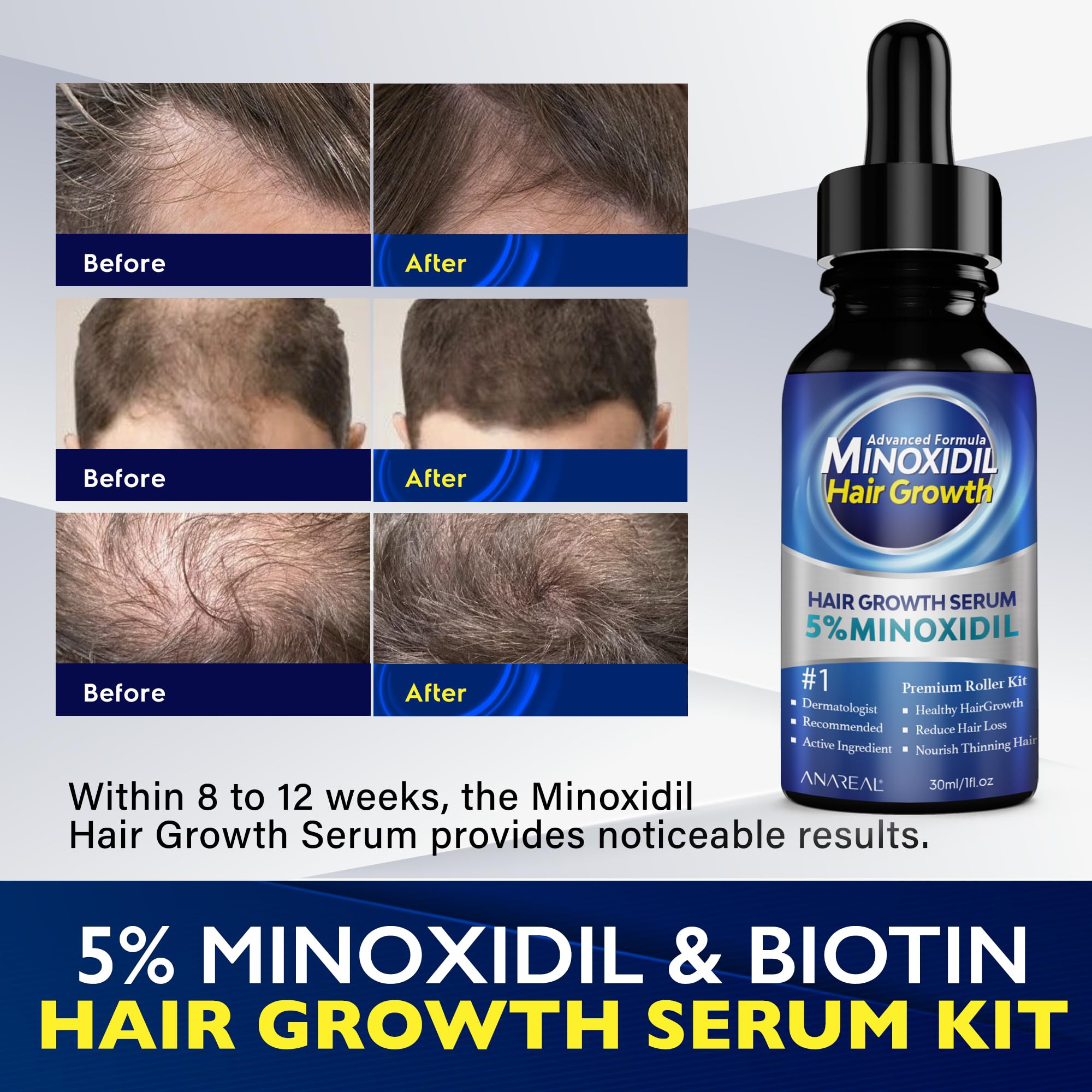 5% Minoxidil Hair Growth Treatment for Men & Women - Beard Growth Kit with Dropper & Spray - Effective for Thinning Hair, Baldness & Facial Hair - Perfect for Home Use & Daily Hair Care Routine